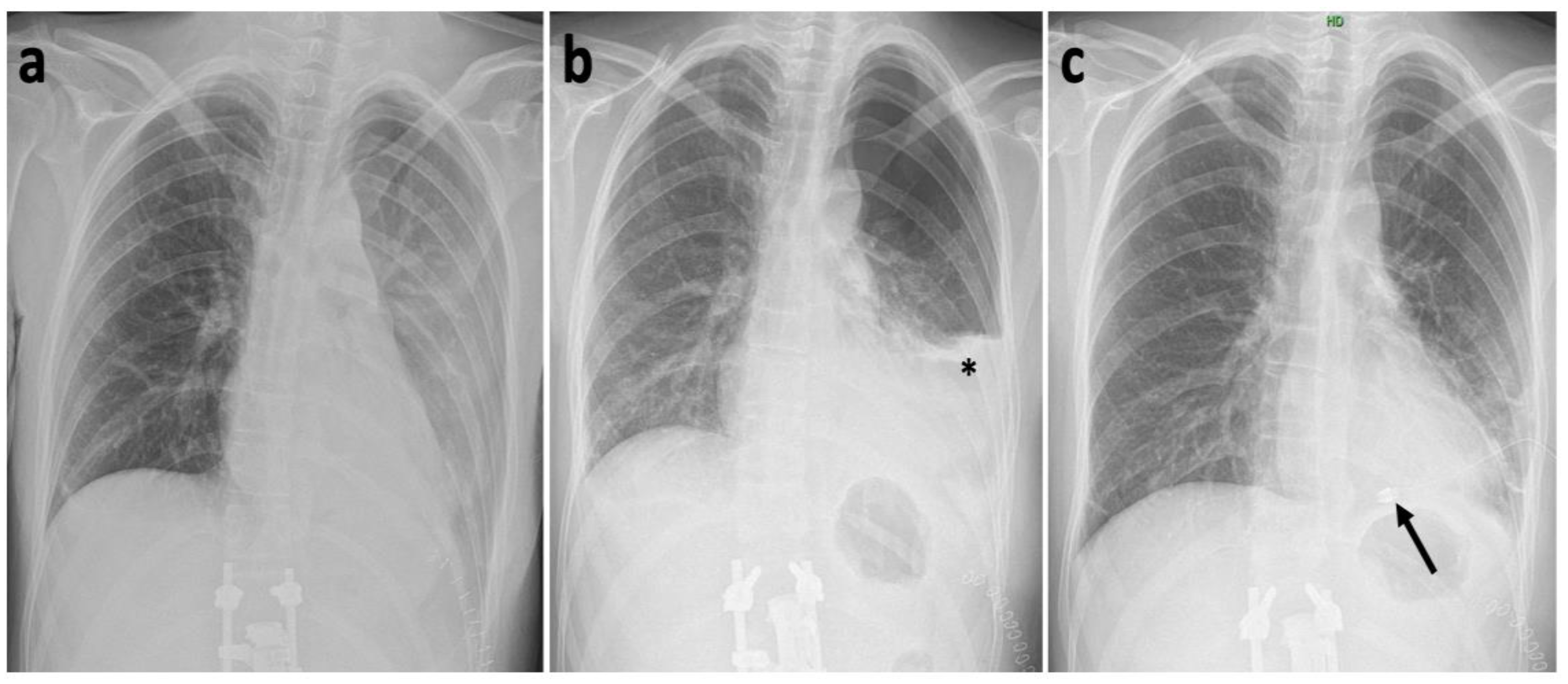 Medicina 57 01328 g006 550