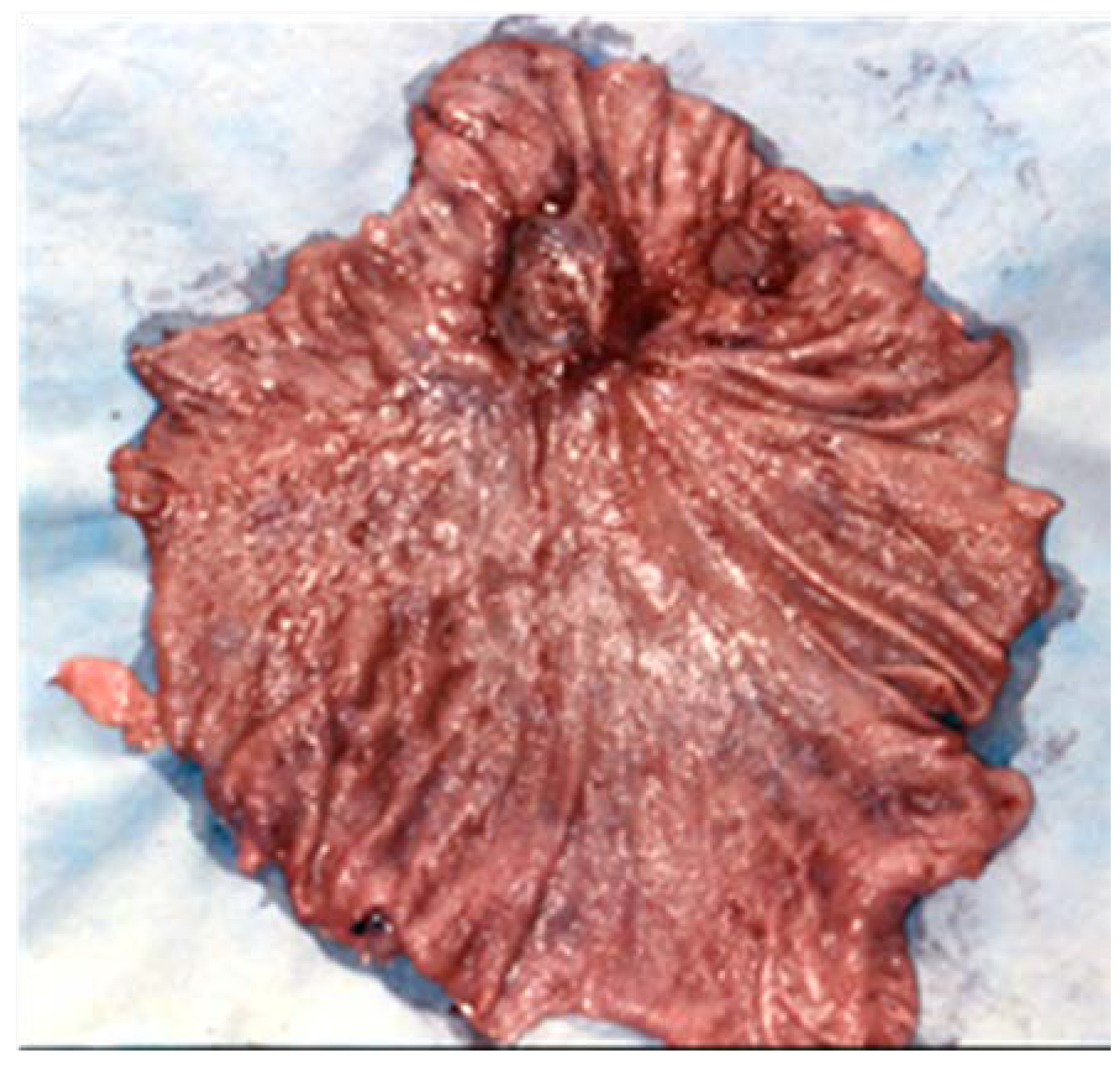 Medicina 57 01345 g005