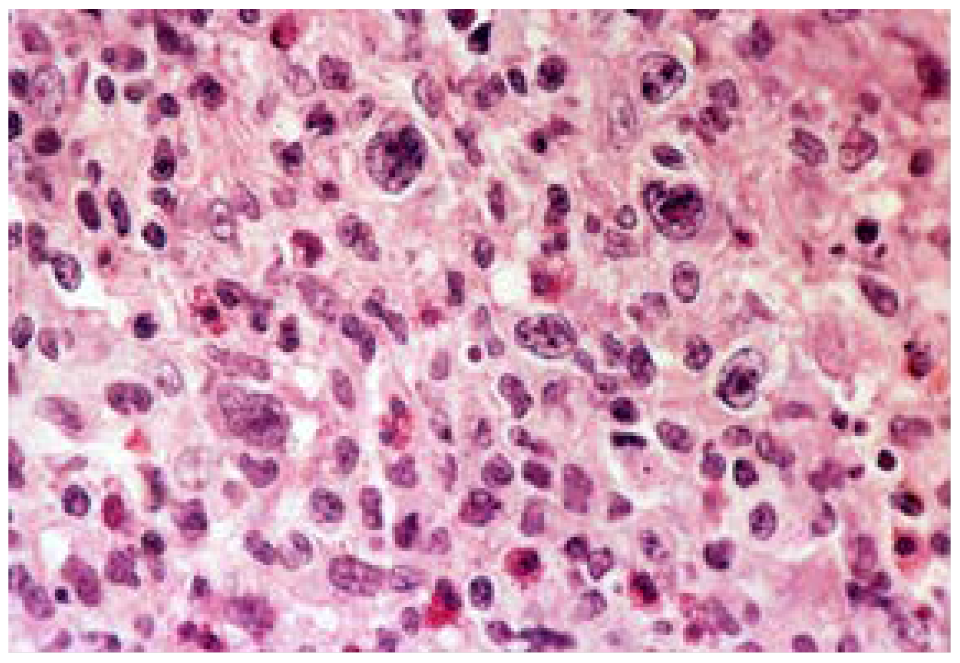 Medicina 57 01345 g008