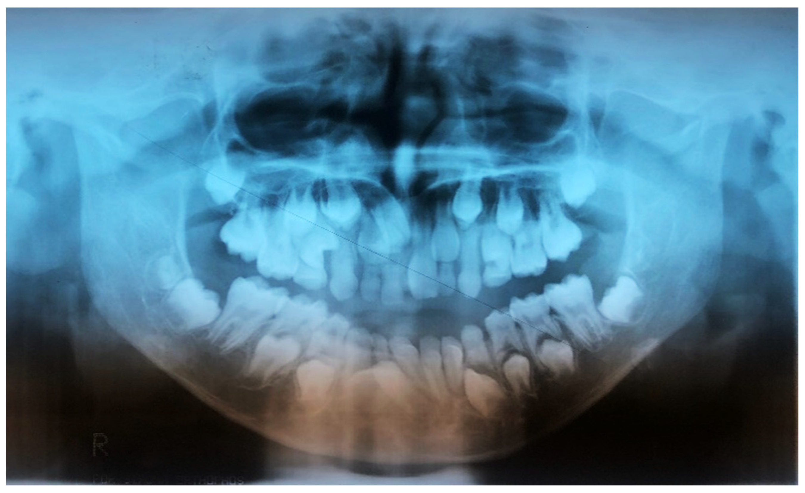 Medicina 57 01350 g003