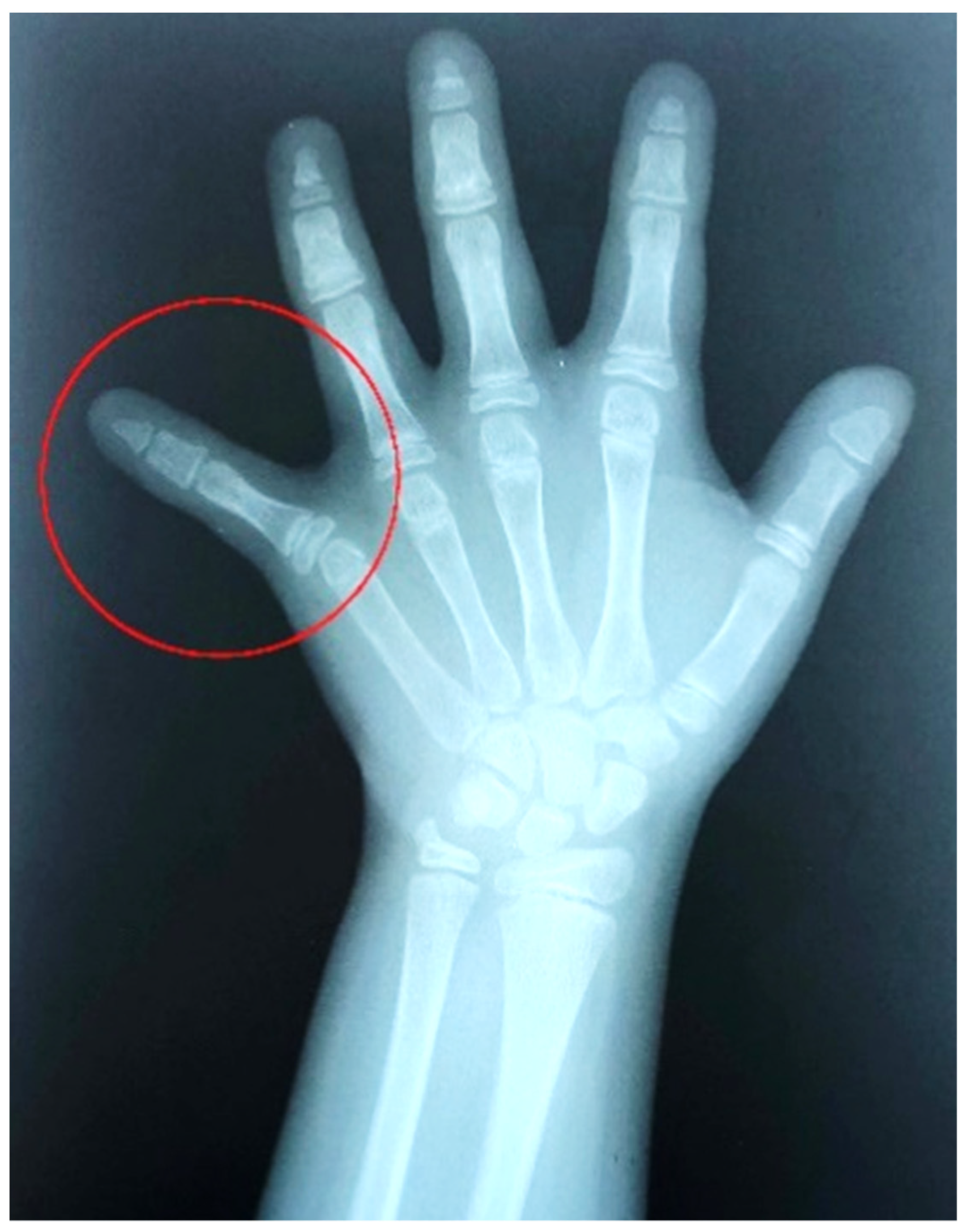 Medicina 57 01350 g004