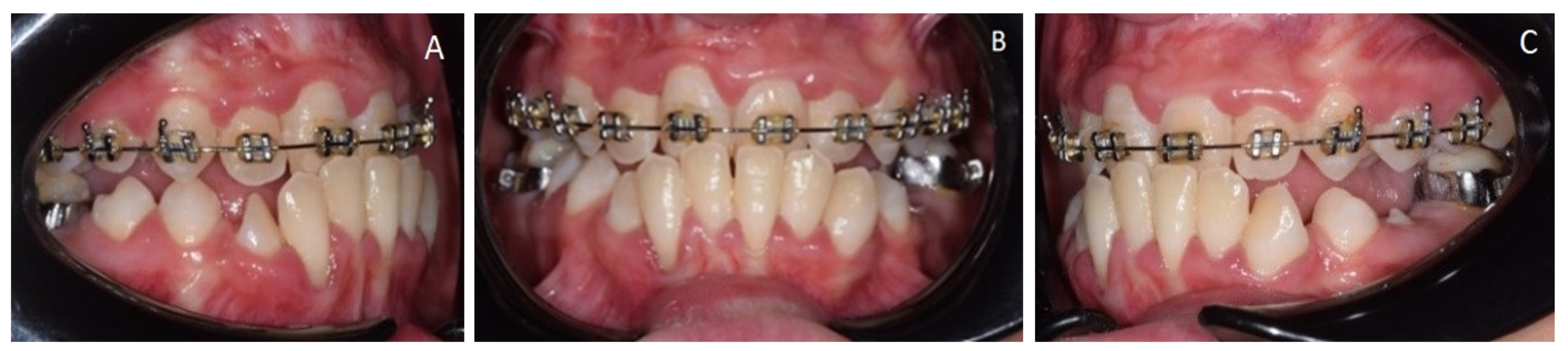 Medicina 57 01350 g006