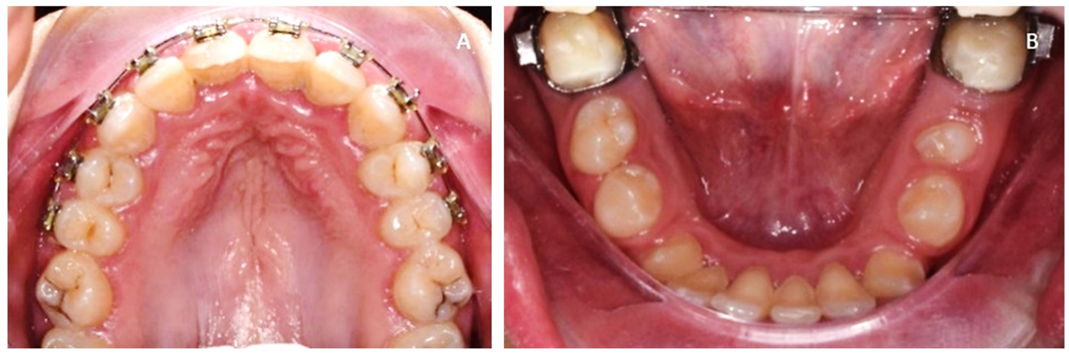 Medicina 57 01350 g007