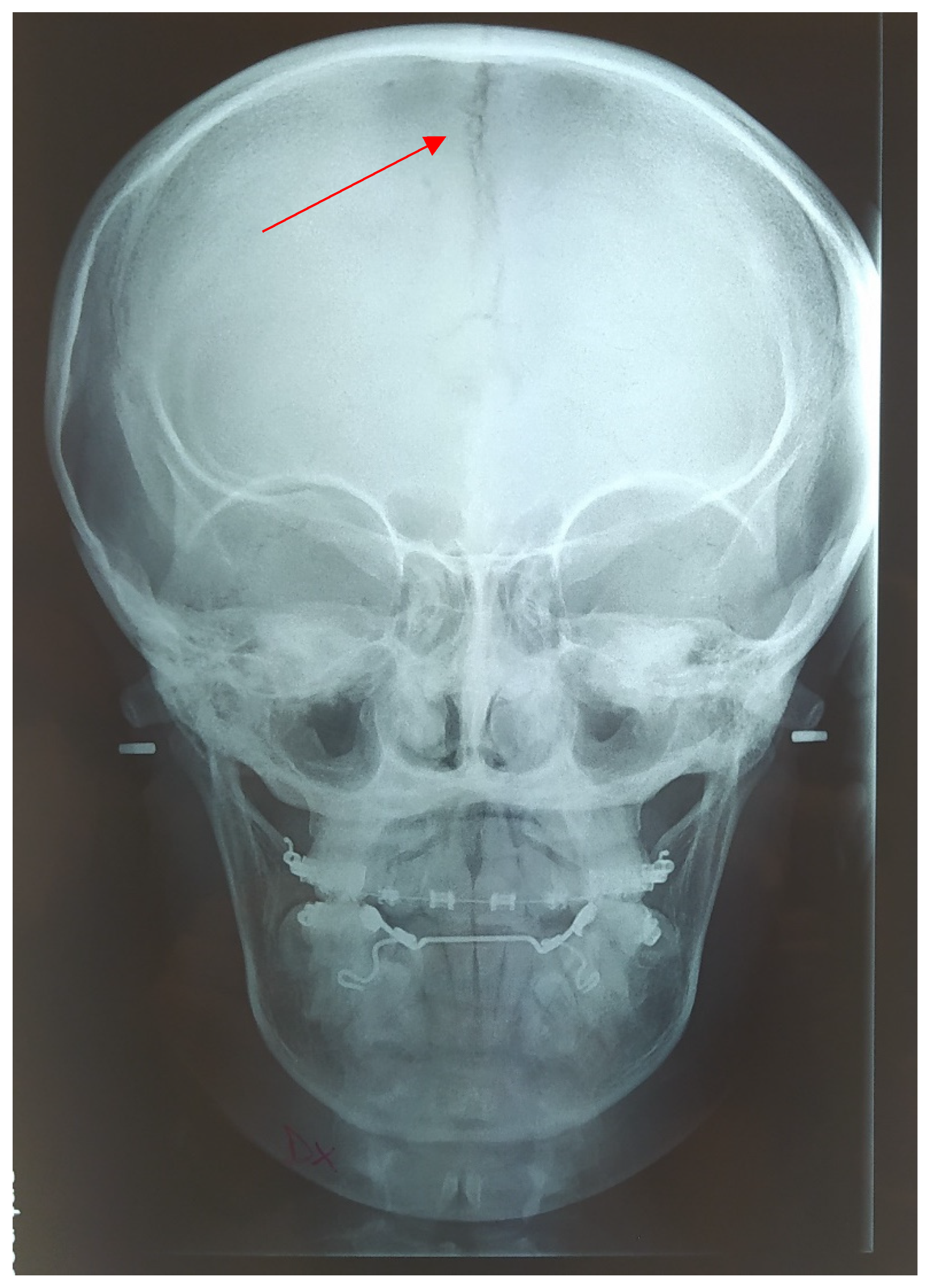 Medicina 57 01350 g014