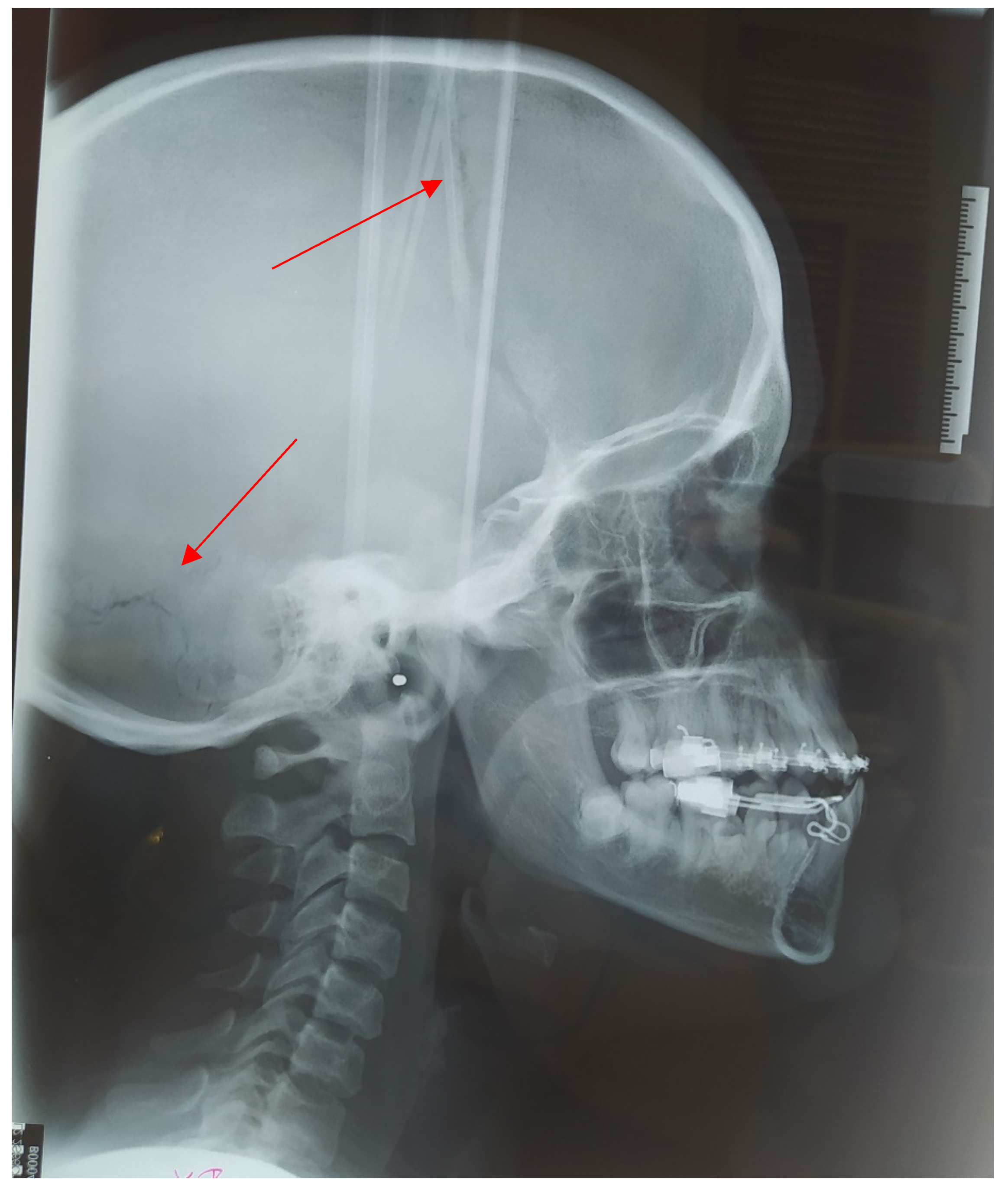 Medicina 57 01350 g015