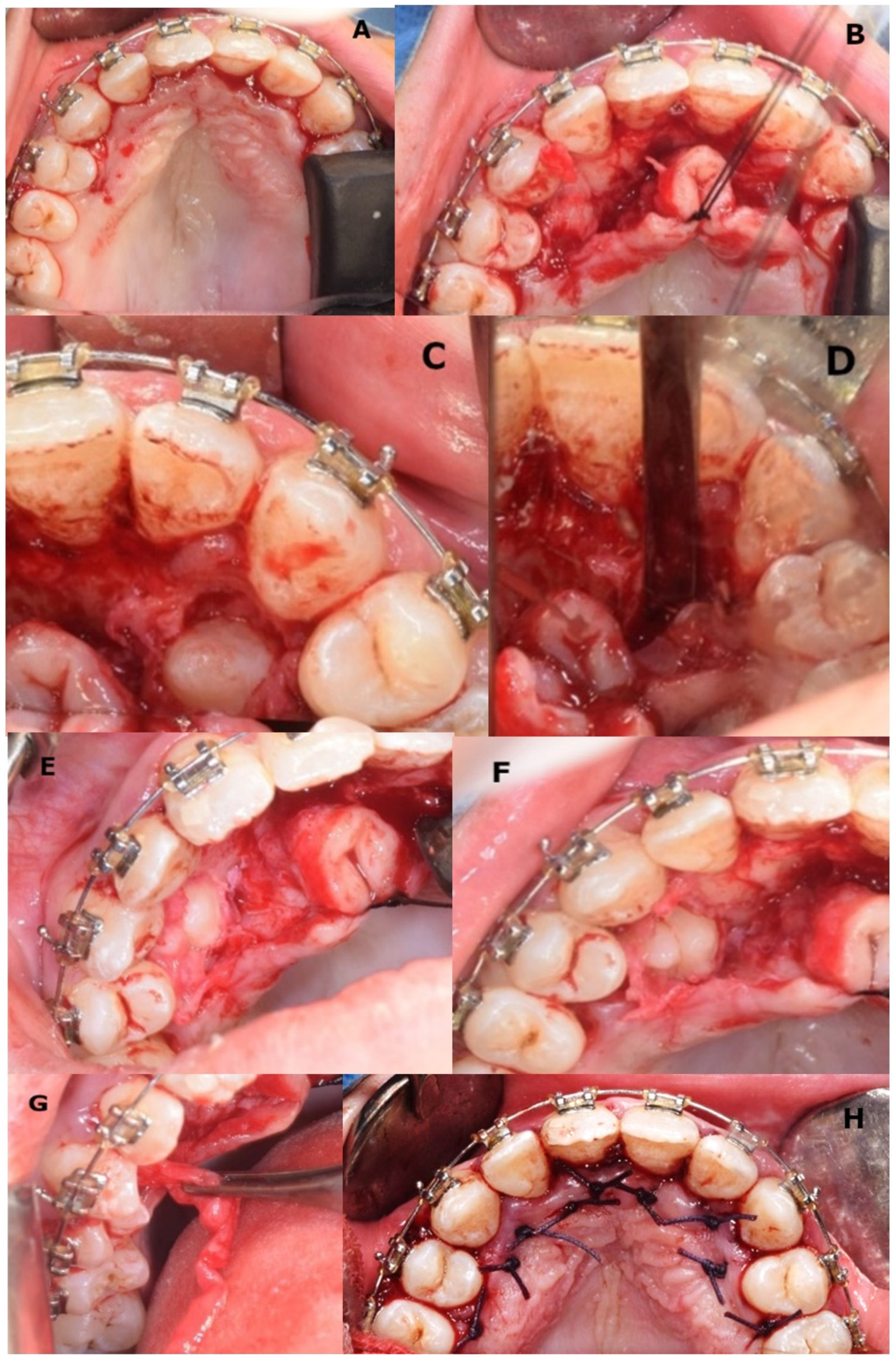 Medicina 57 01350 g017