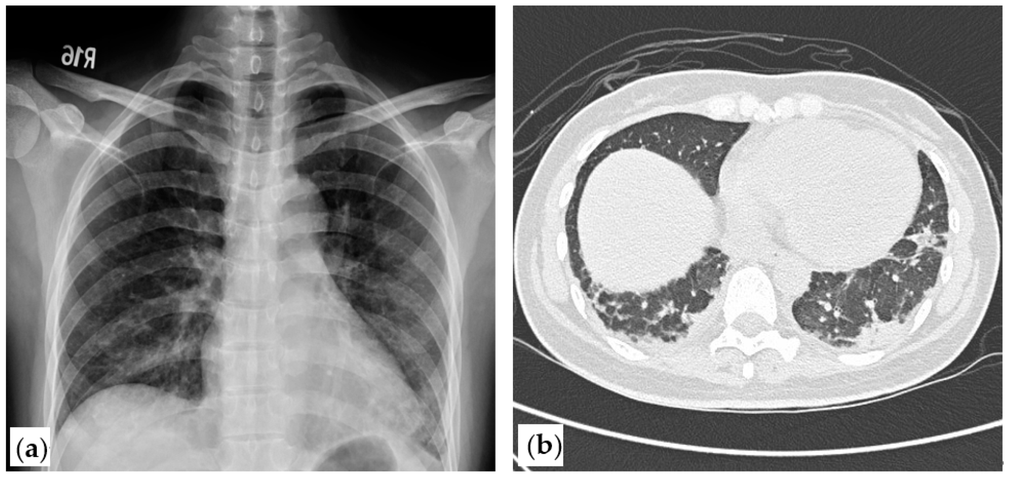 Medicina 57 01358 g001 550