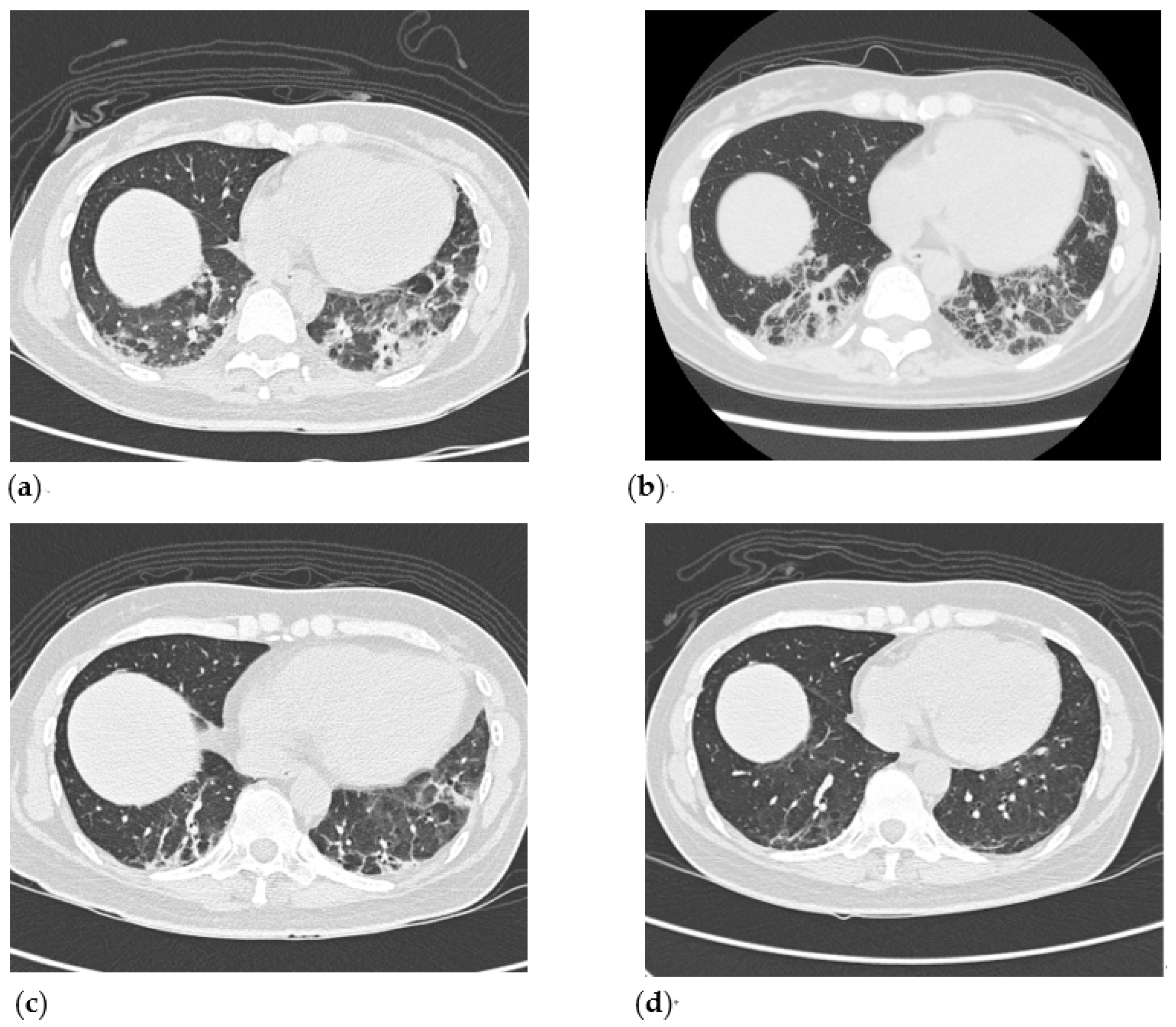 Medicina 57 01358 g003 550