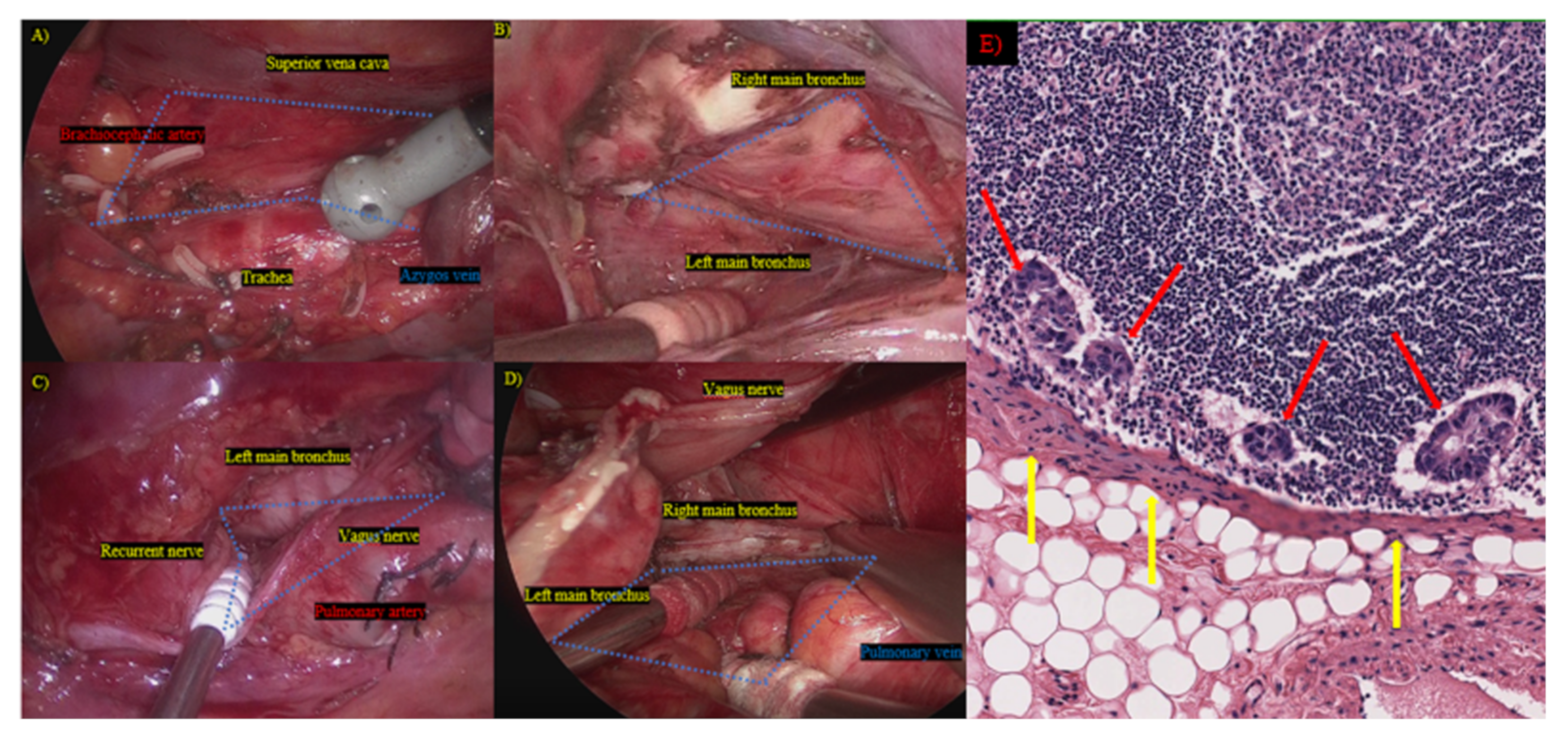 Medicina 57 01365 g002