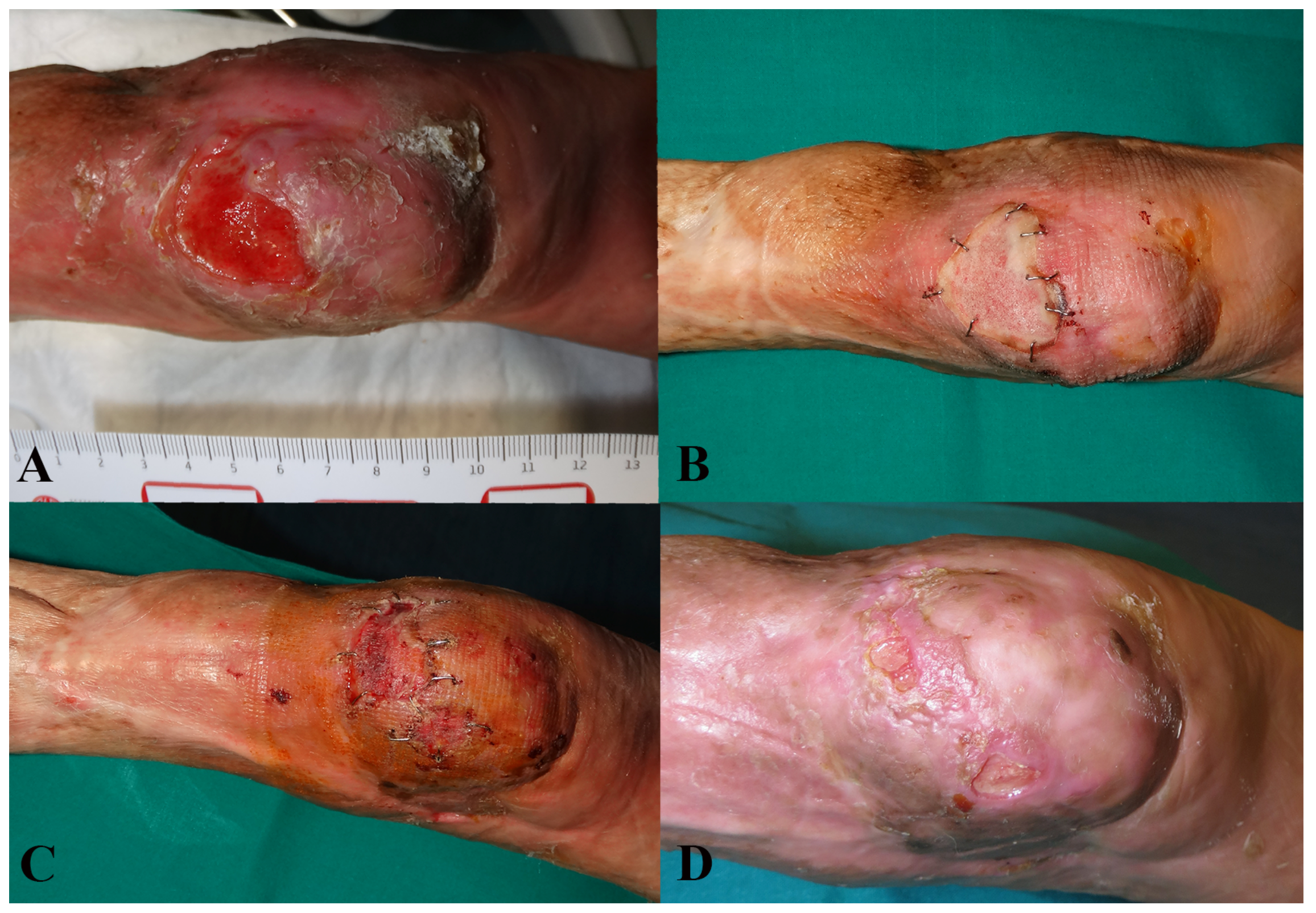 Medicina 57 01367 g005 550