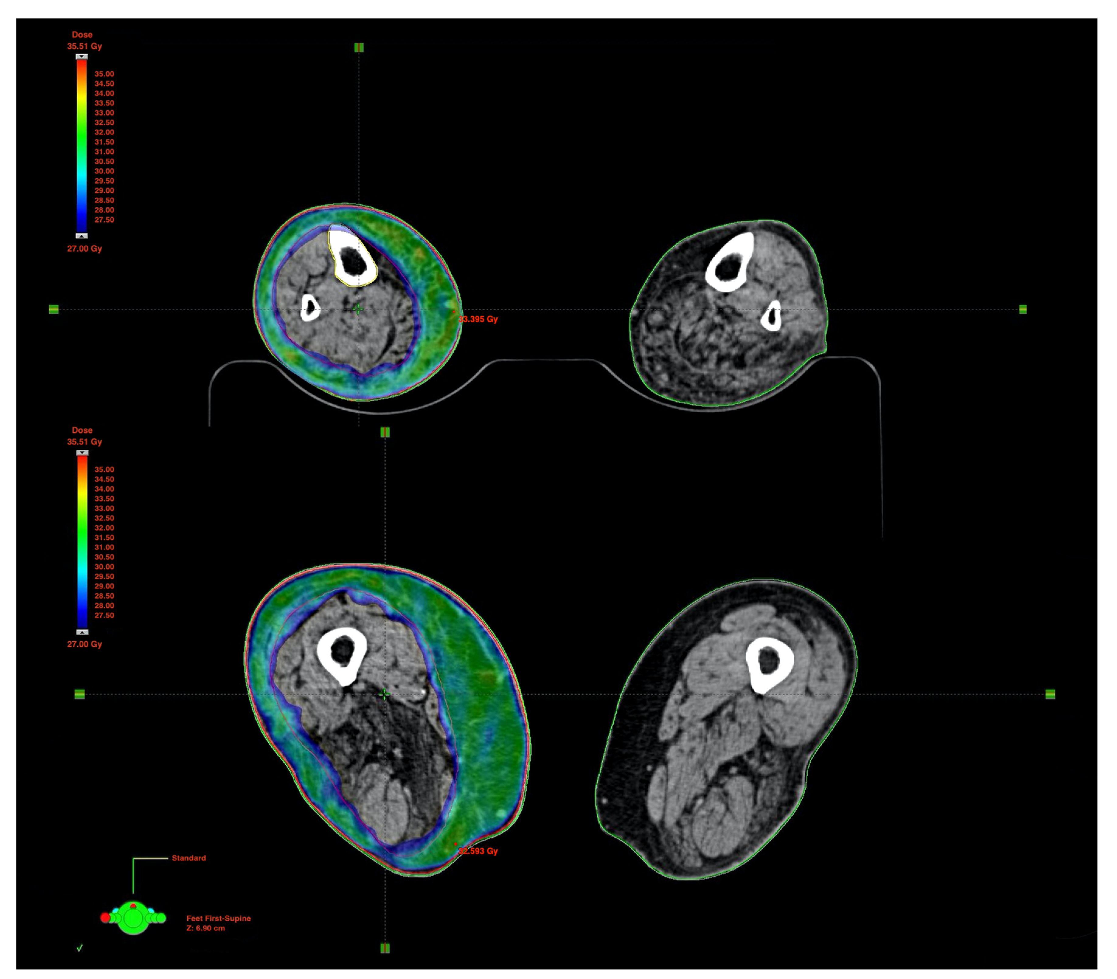 Medicina 57 01379 g003