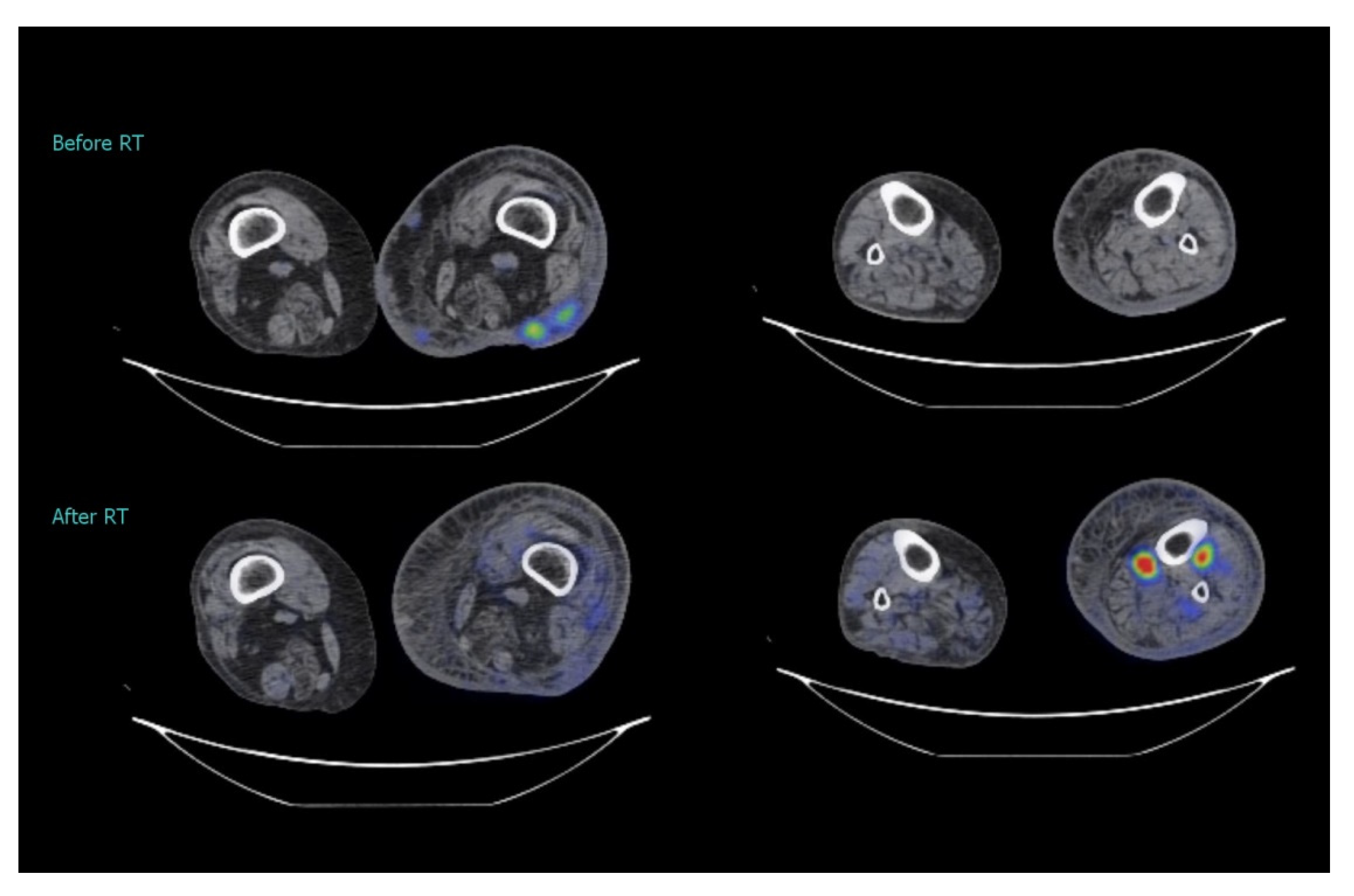 Medicina 57 01379 g005