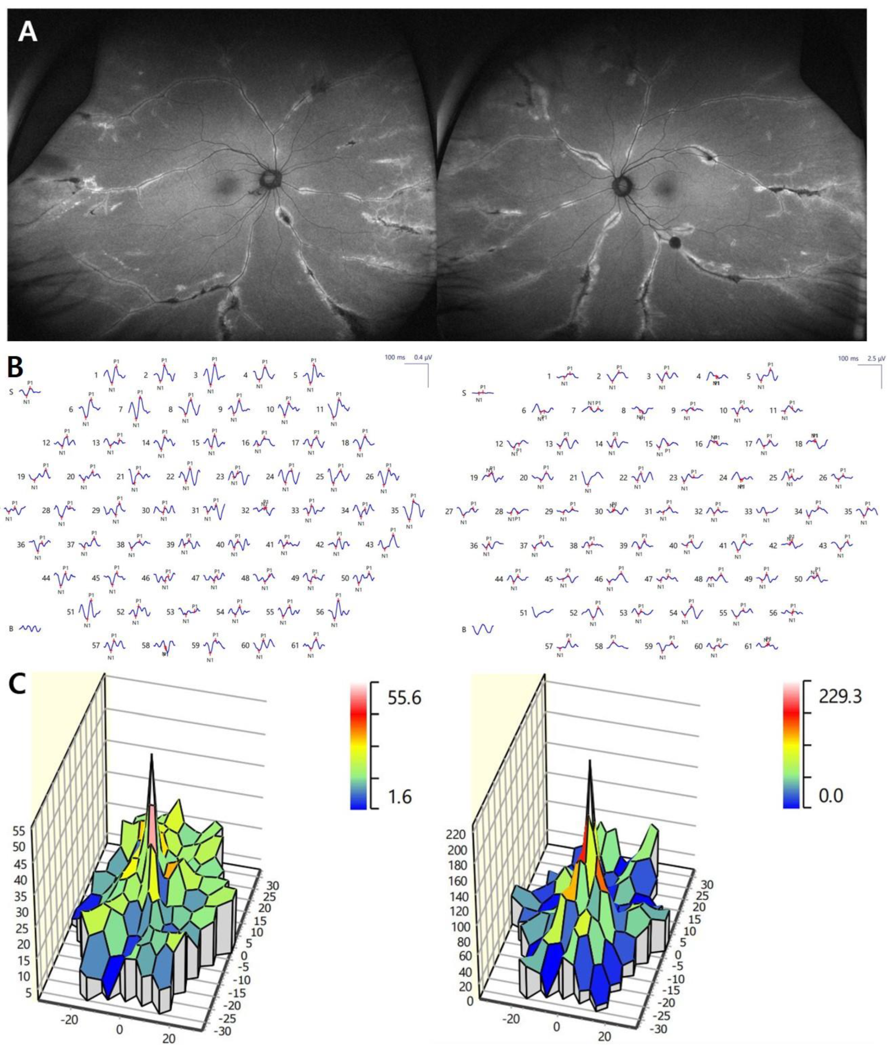 Medicina 57 01382 g002 550