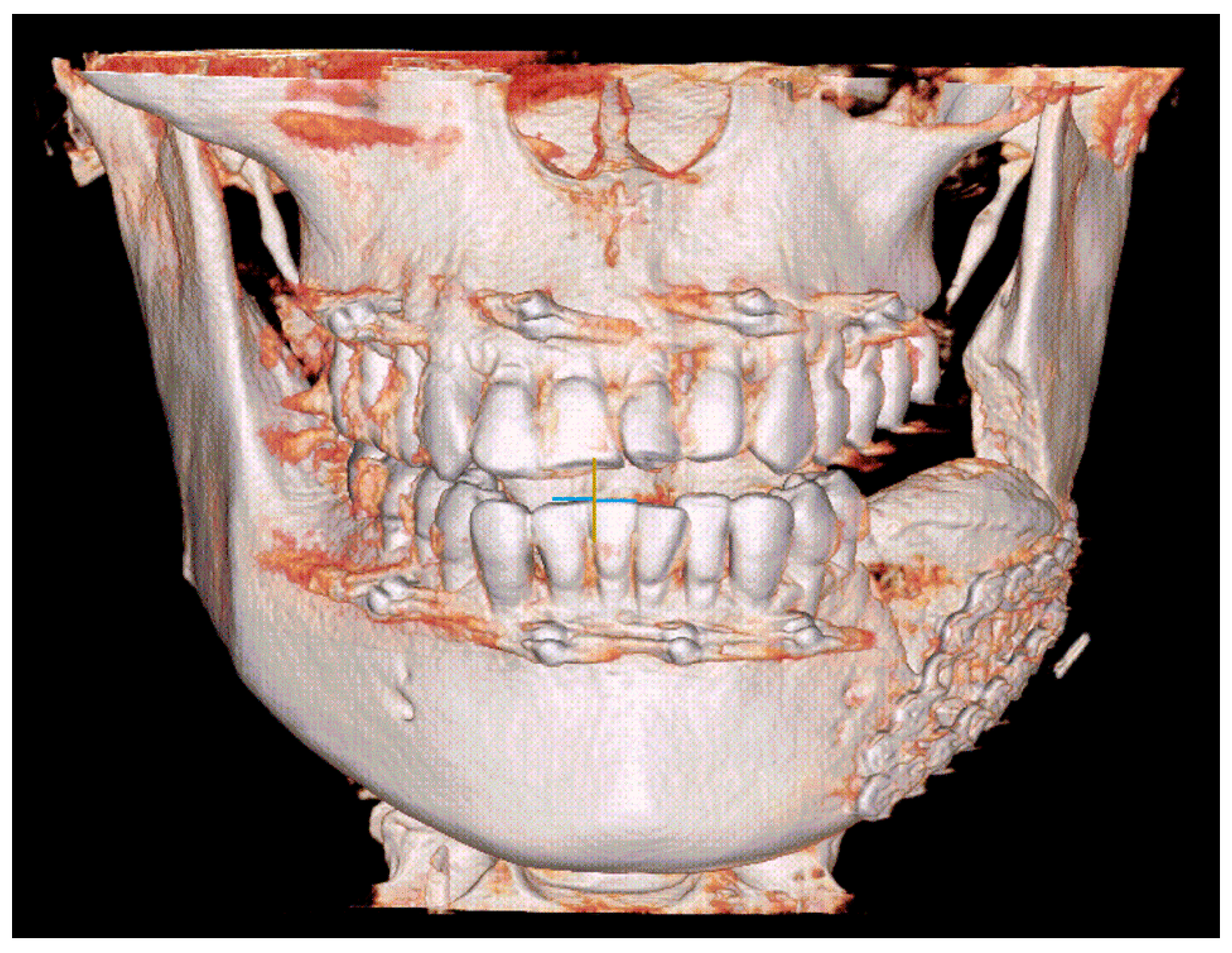 Medicina 57 01383 g003 550