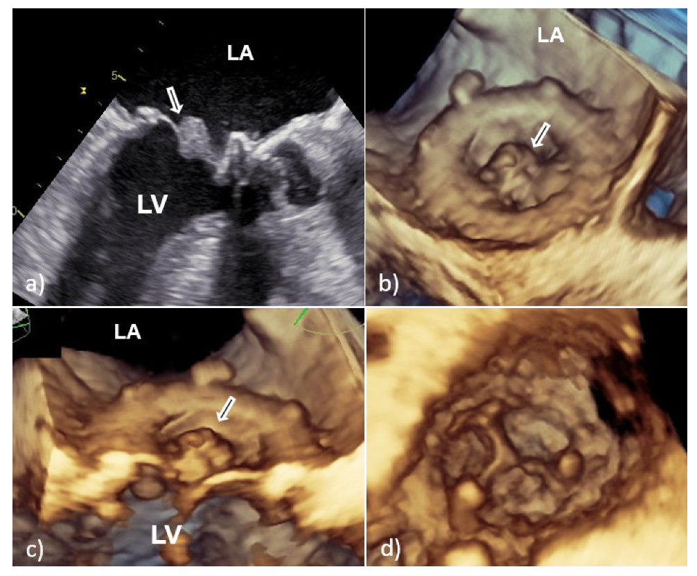 Medicina 58 00023 g003