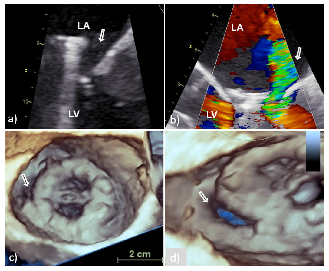 Medicina 58 00023 g004