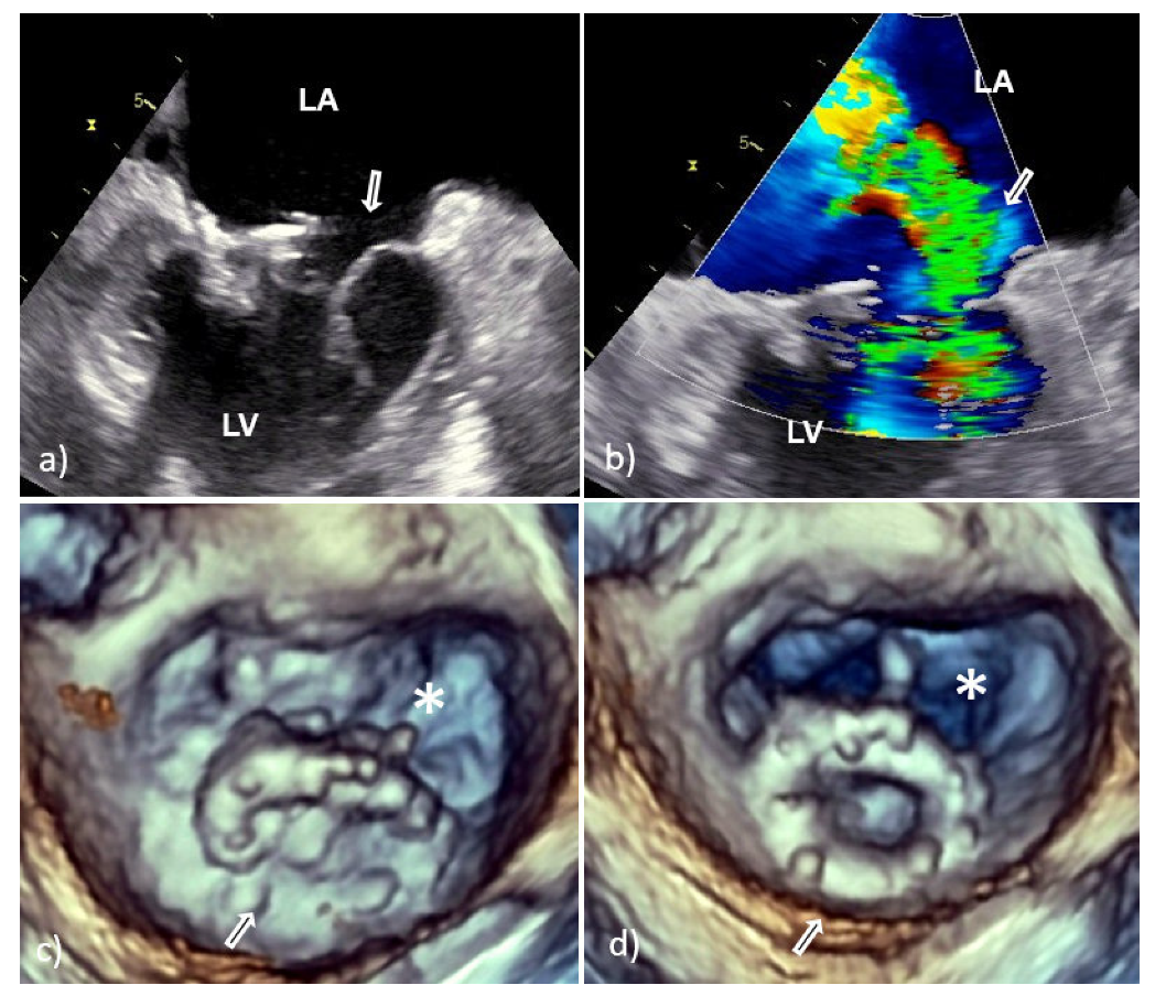 Medicina 58 00023 g005