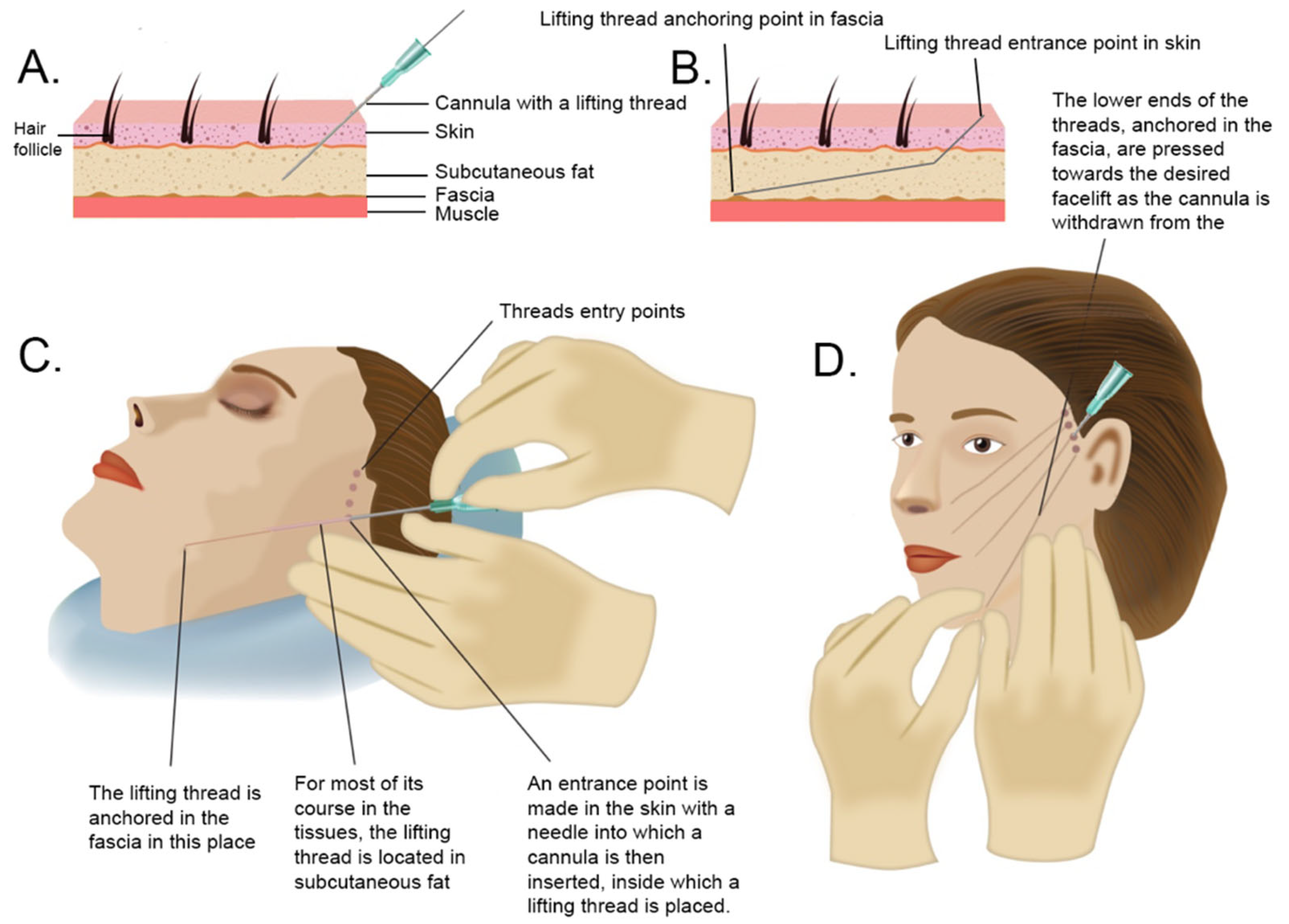 Medicina 58 00030 g002