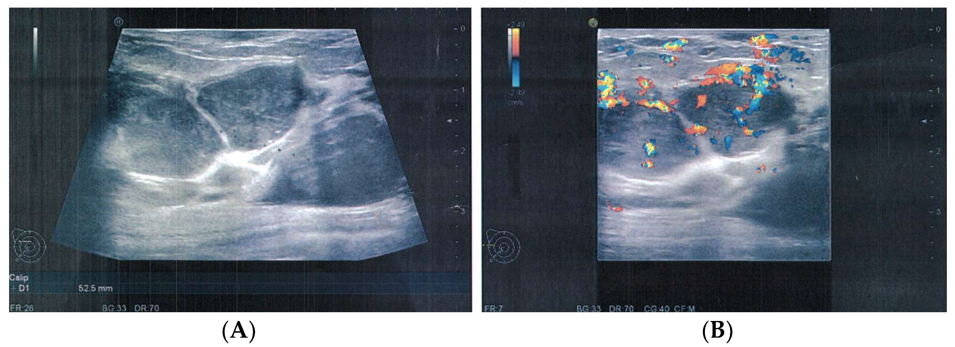 Medicina 58 00036 g005