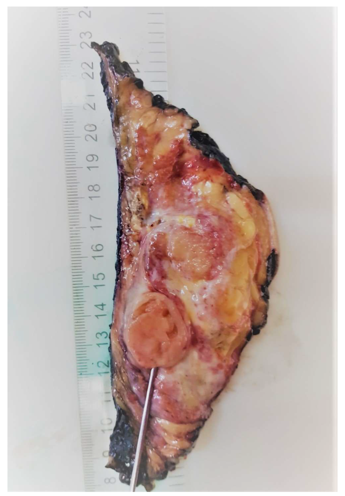 Medicina 58 00036 g006