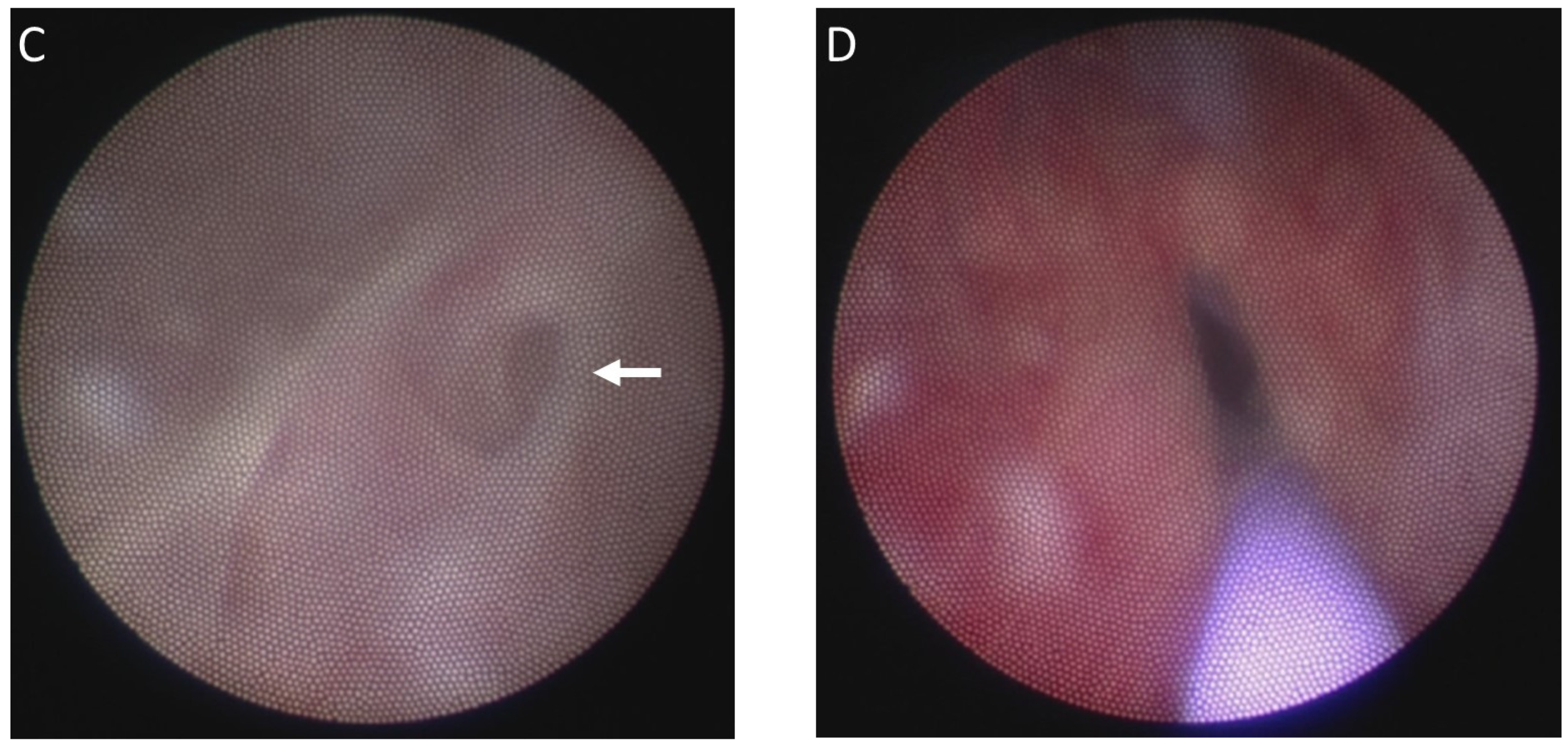 Medicina 58 00040 g002b