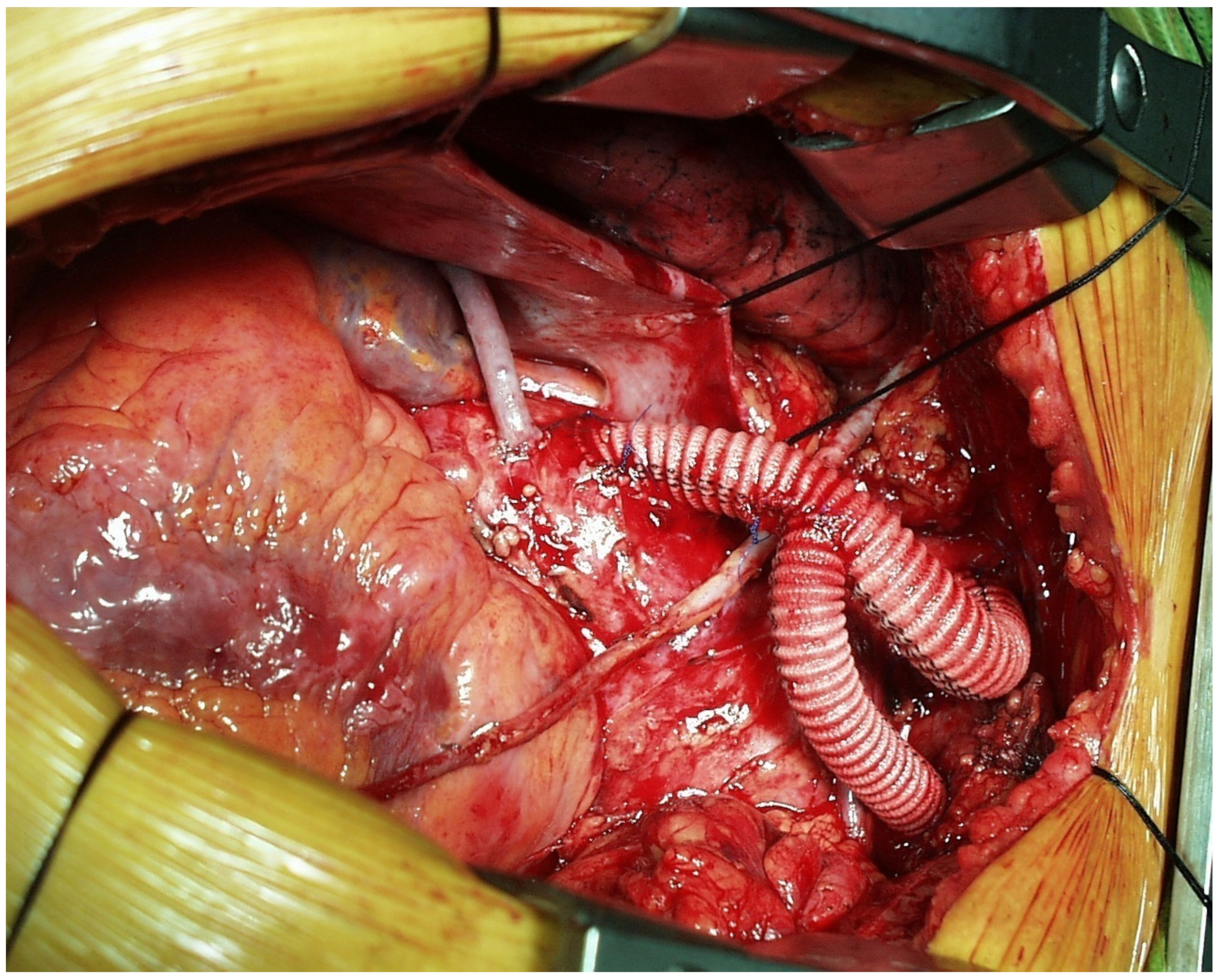 Medicina 58 00049 g001