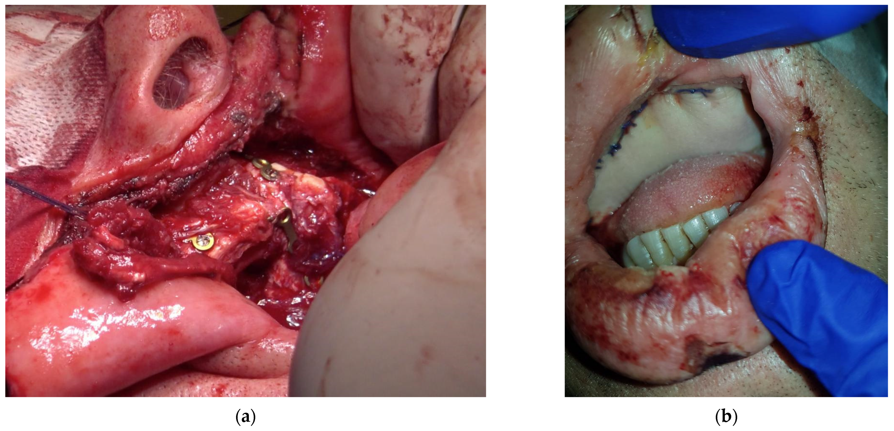 Medicina 58 00054 g004
