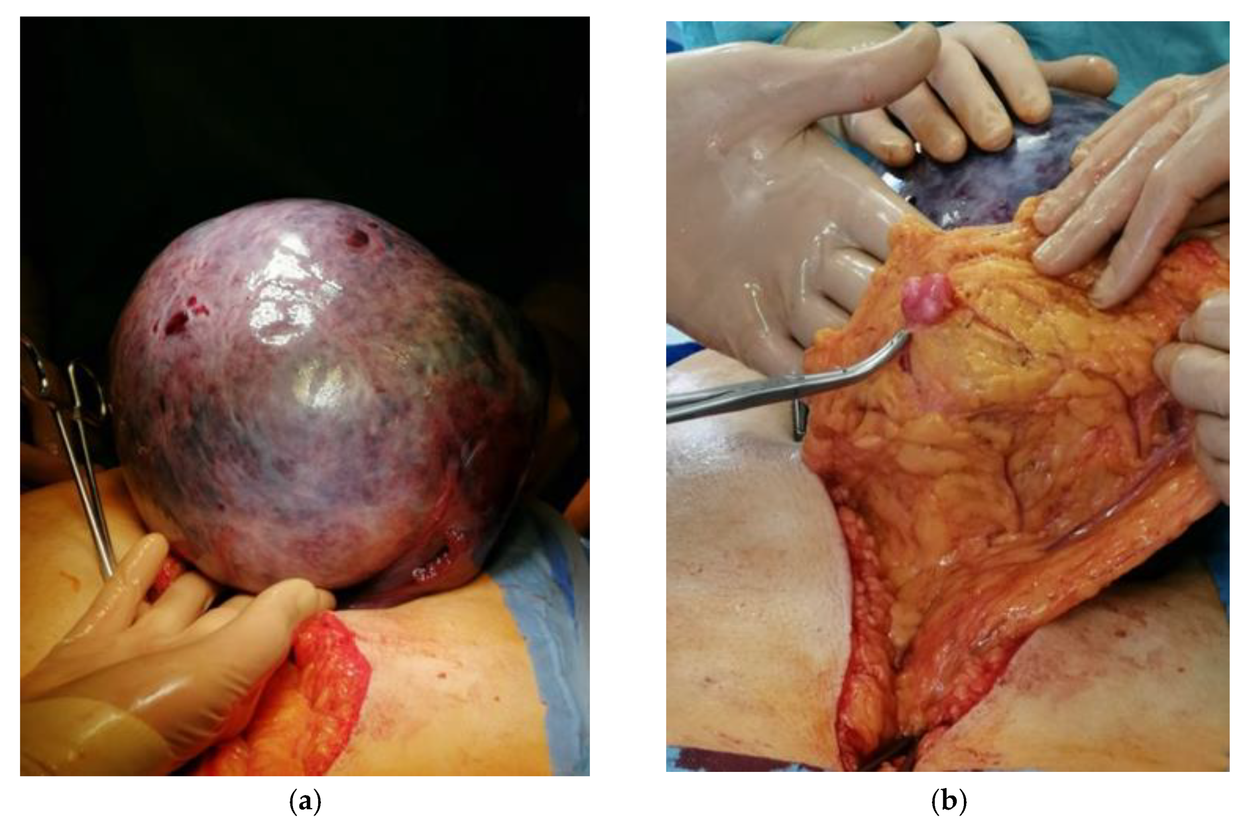 Medicina 58 00089 g002 550