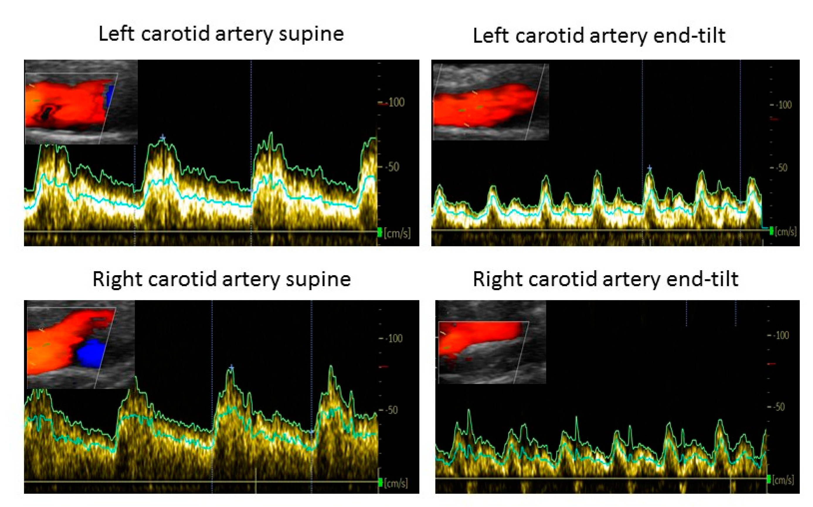 Medicina 58 00098 g002 550
