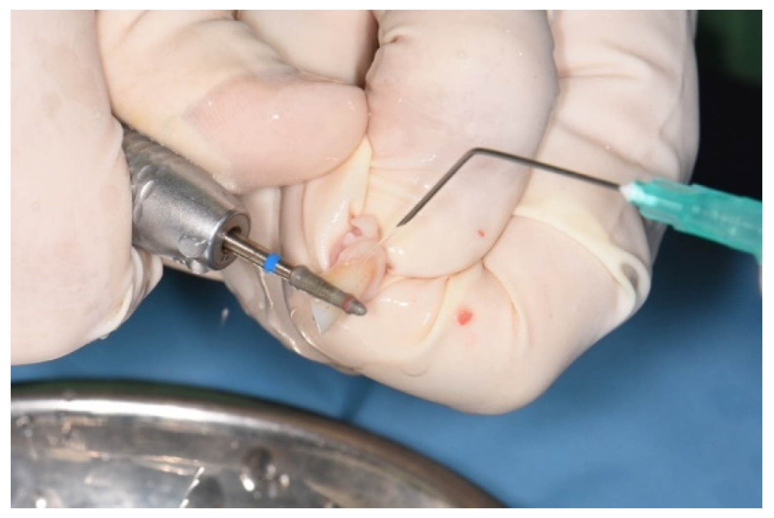 Medicina 58 00103 g005 Medicina 58 00103 g005