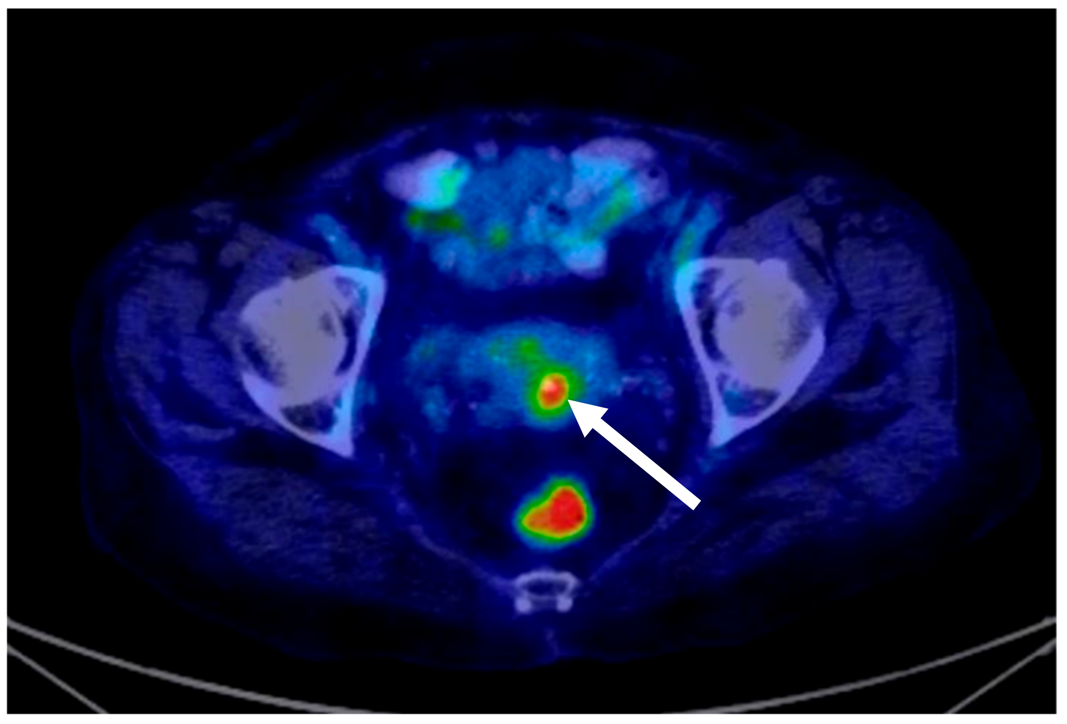 Medicina 58 00106 g002 550