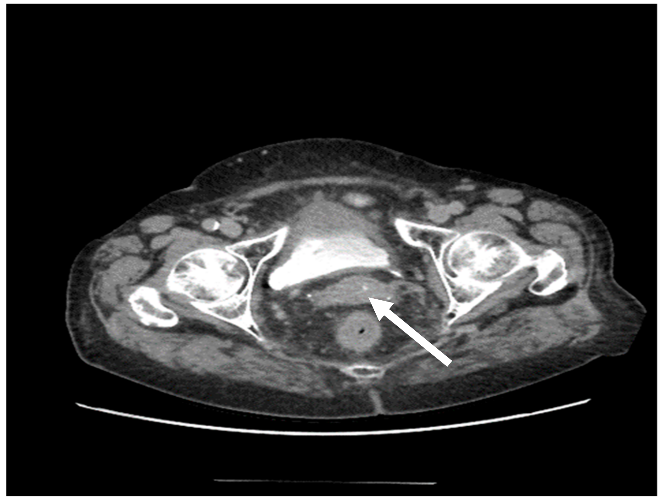 Medicina 58 00106 g003 550