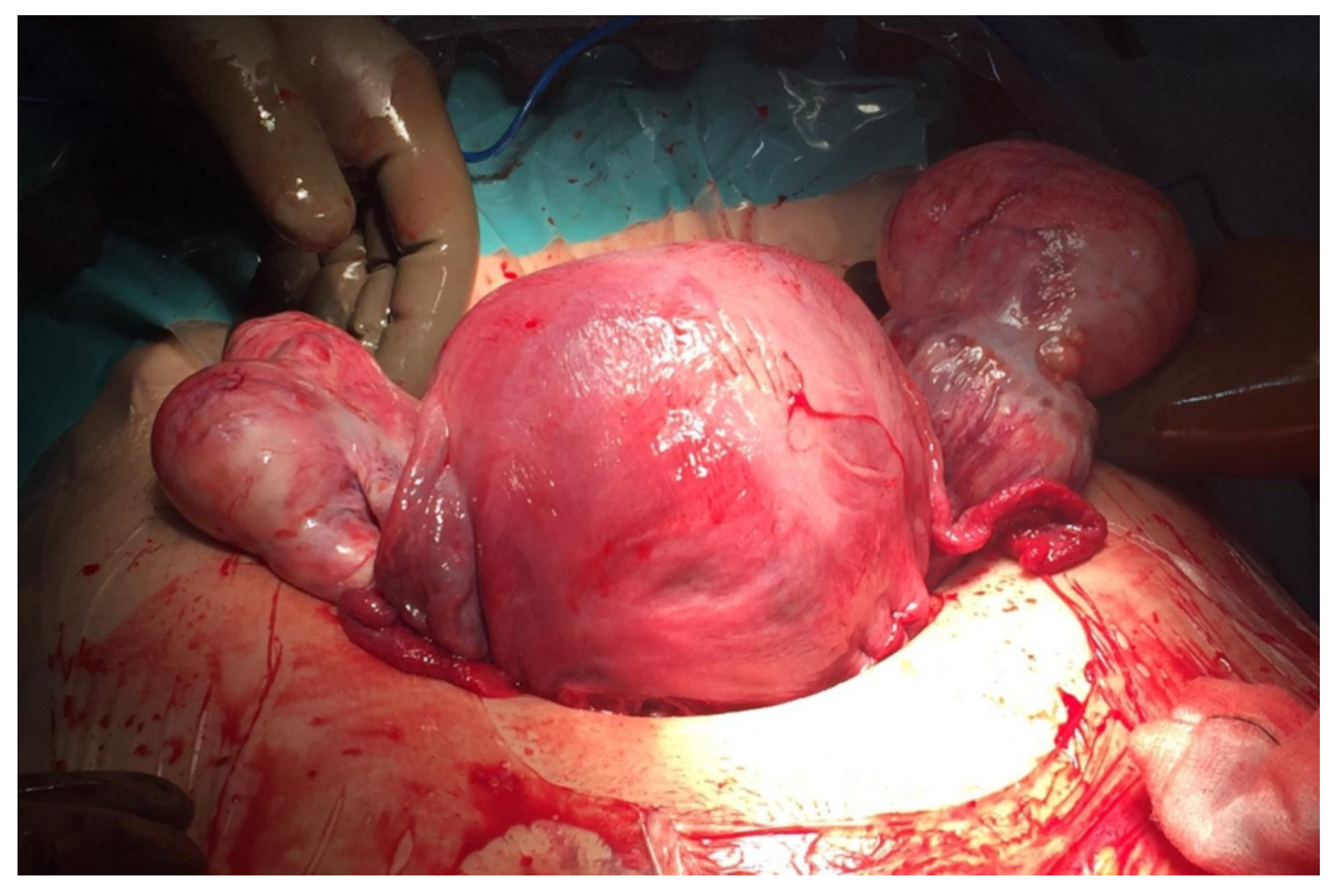 Medicina 58 00107 g004