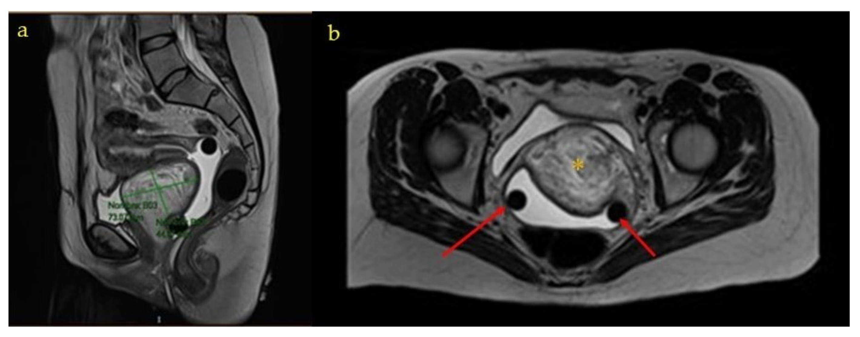 Medicina 58 00107 g005