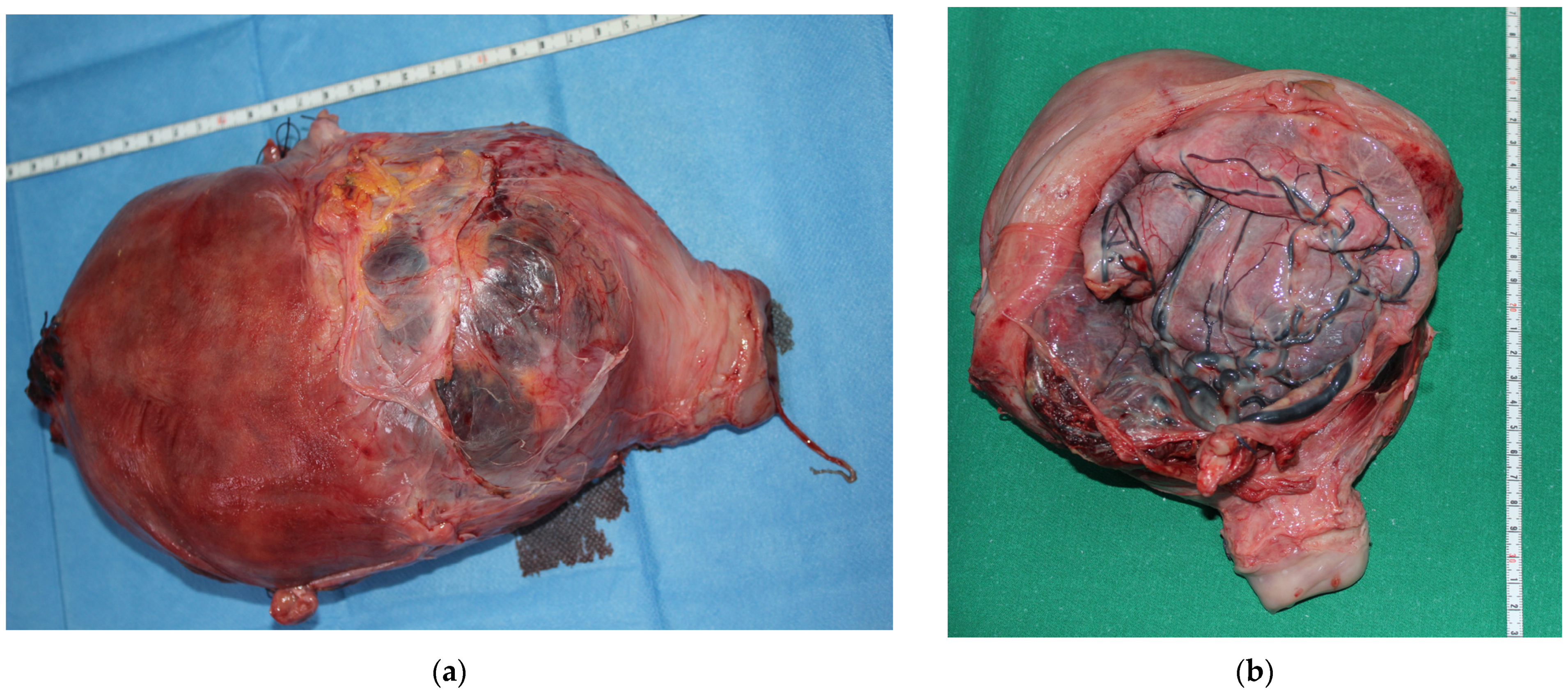 Medicina 58 00111 g001a 550