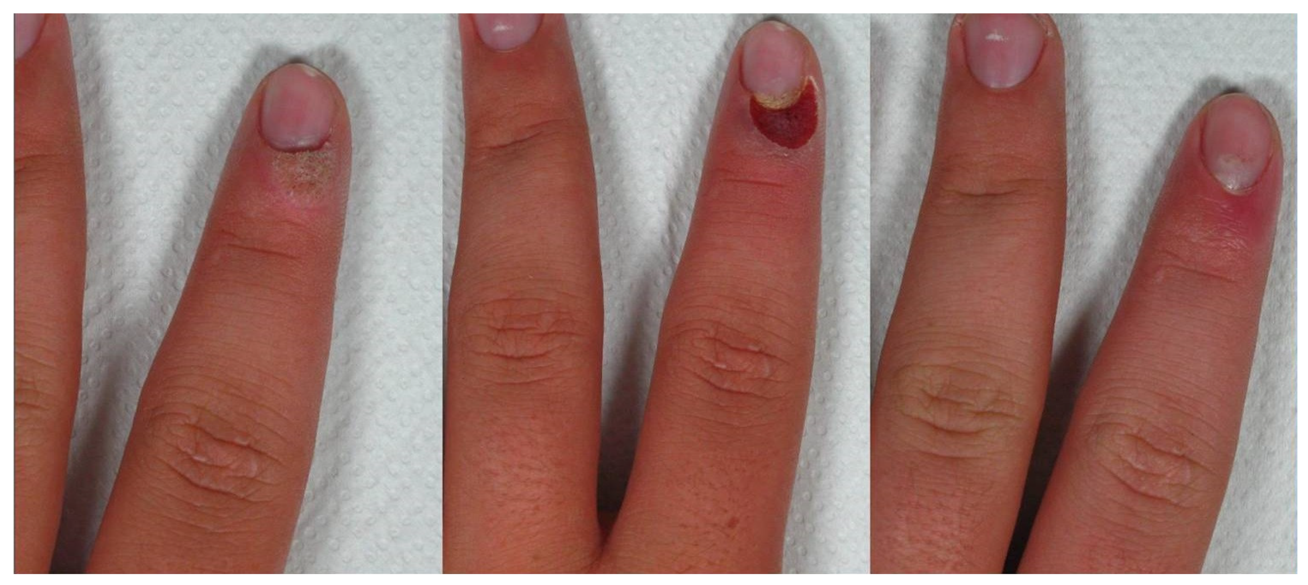 Medicina 58 00115 g001 550