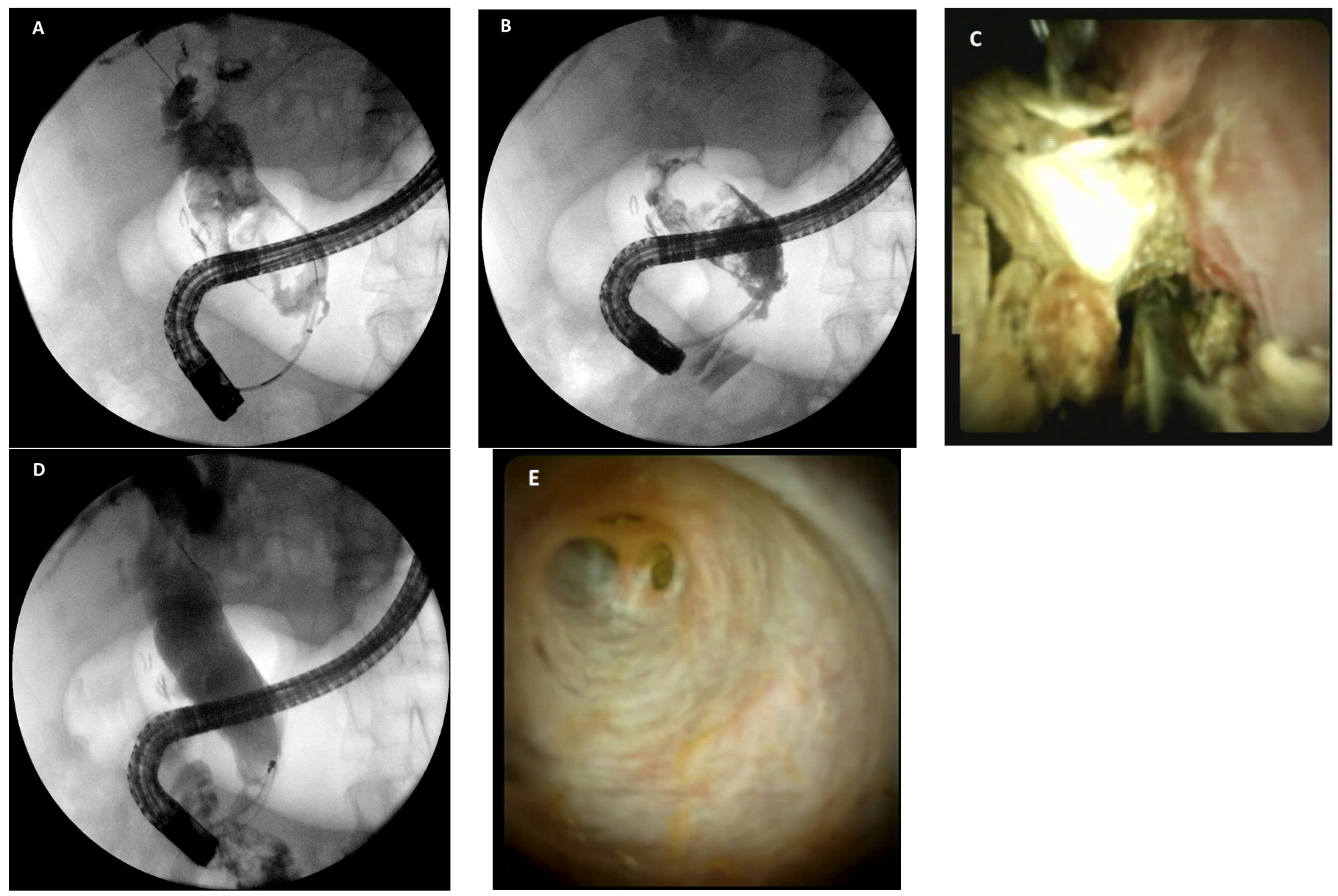 Medicina 58 00120 g003