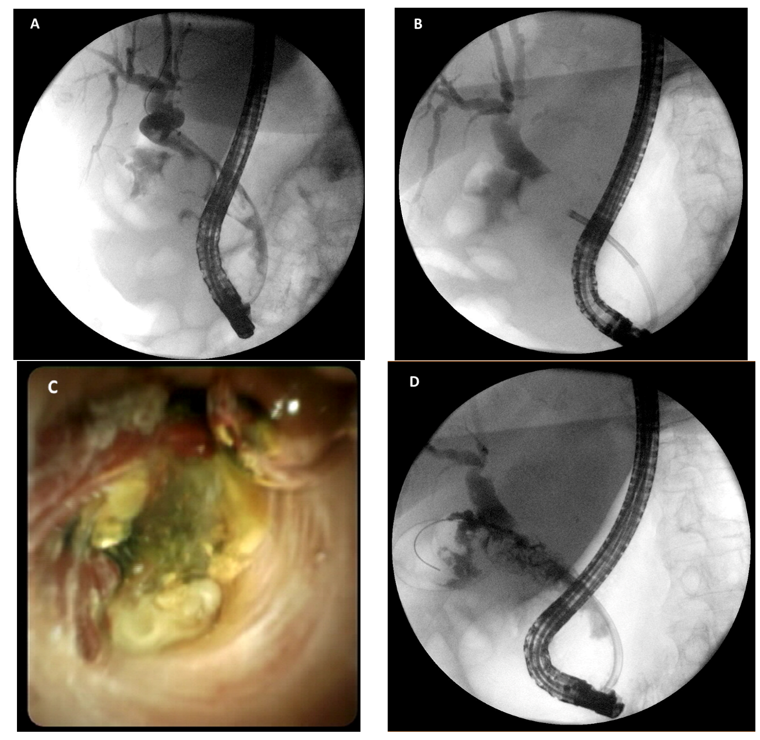 Medicina 58 00120 g004