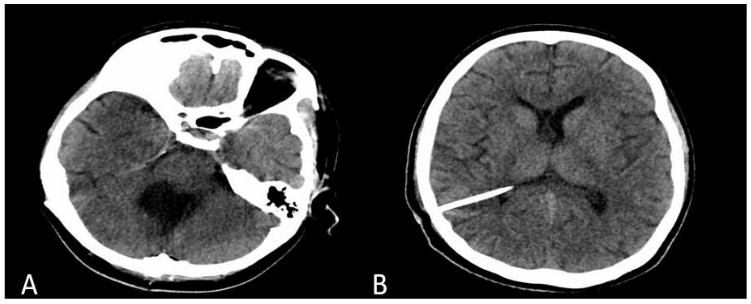 Medicina 58 00127 g002