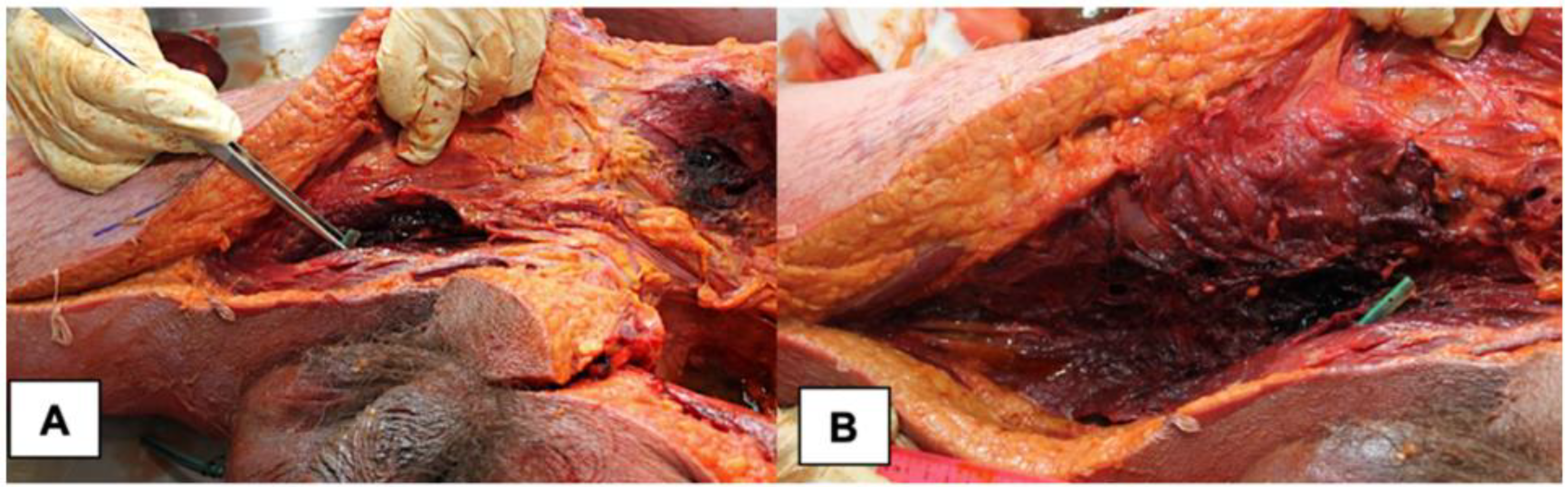 Medicina 58 00131 g003