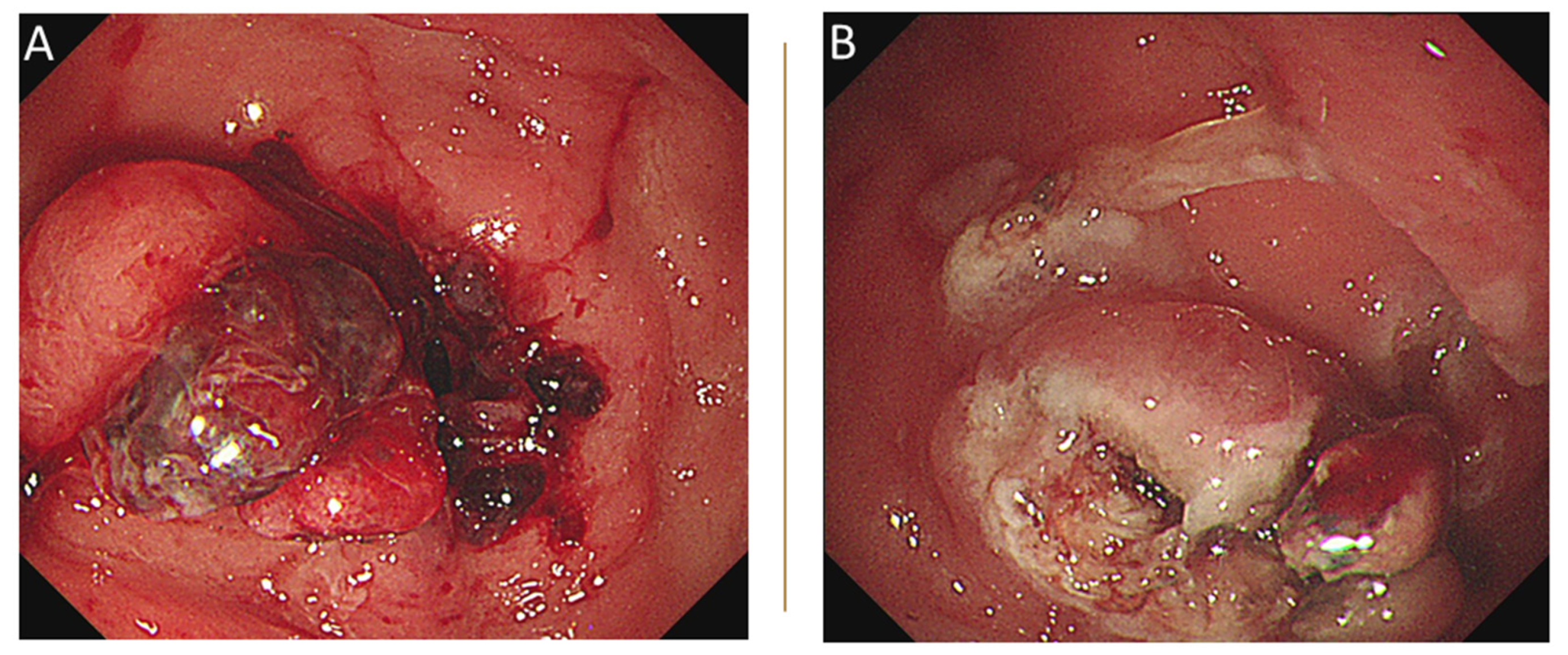 Medicina 58 00134 g002 Medicina 58 00134 g002