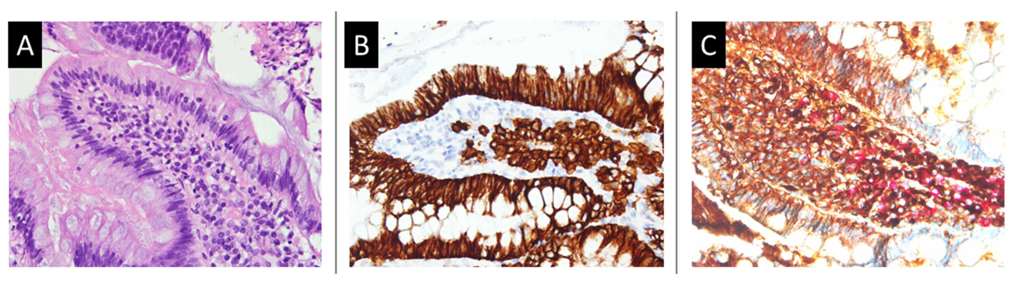 Medicina 58 00134 g003 Medicina 58 00134 g003