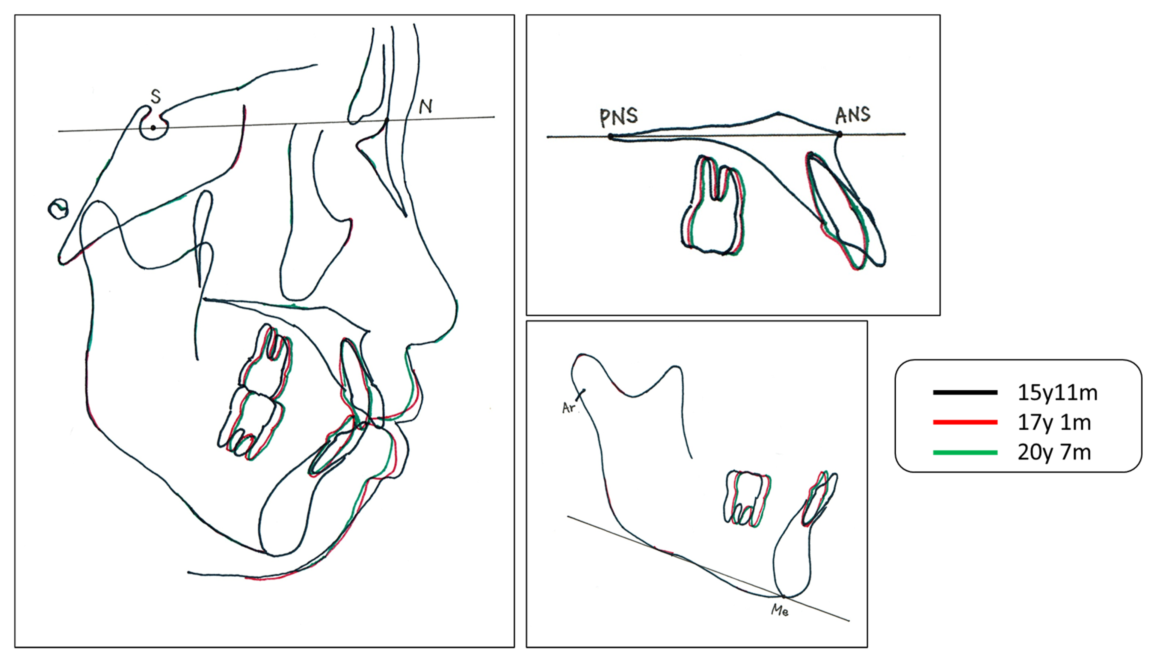 Medicina 58 00150 g005