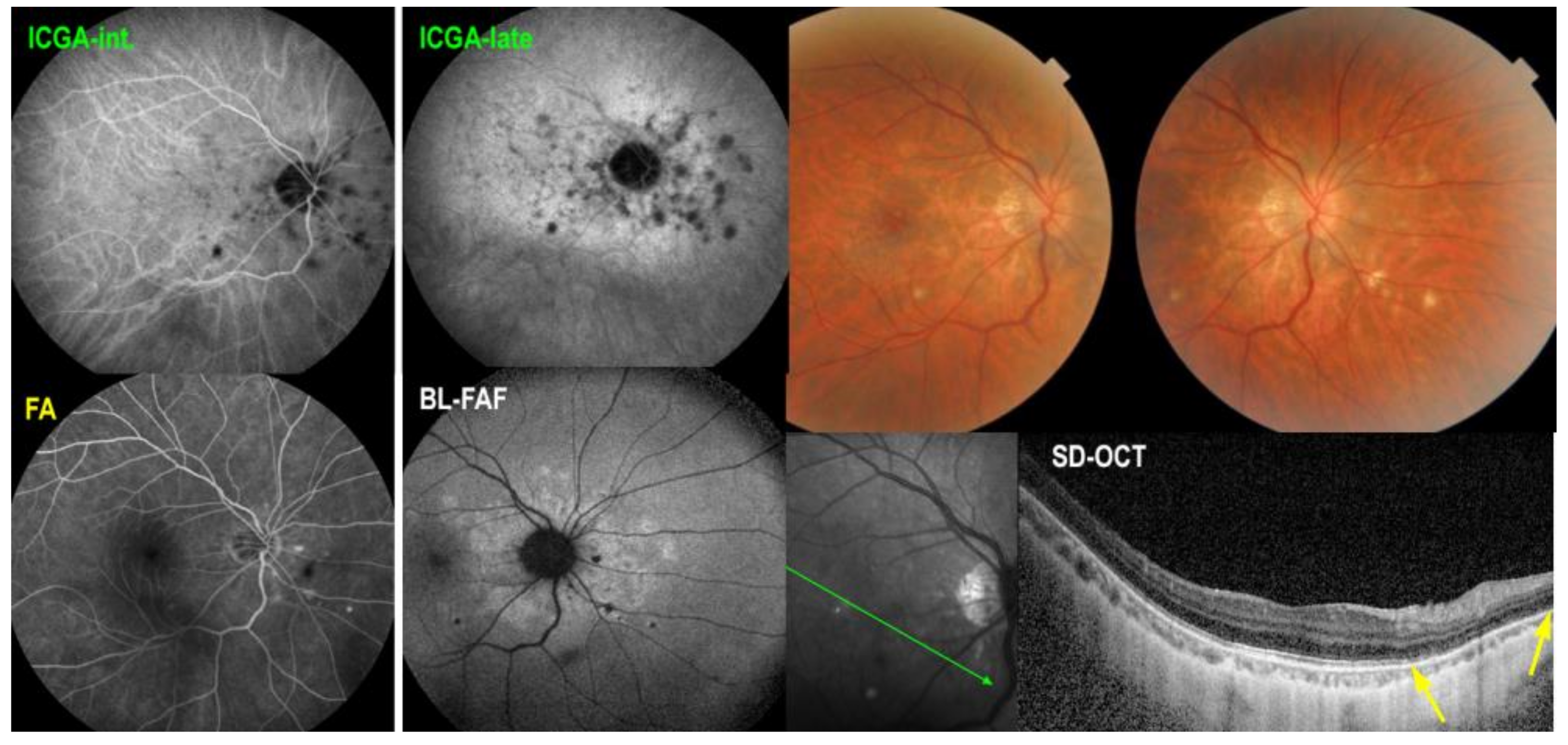 Medicina 58 00165 g003 550