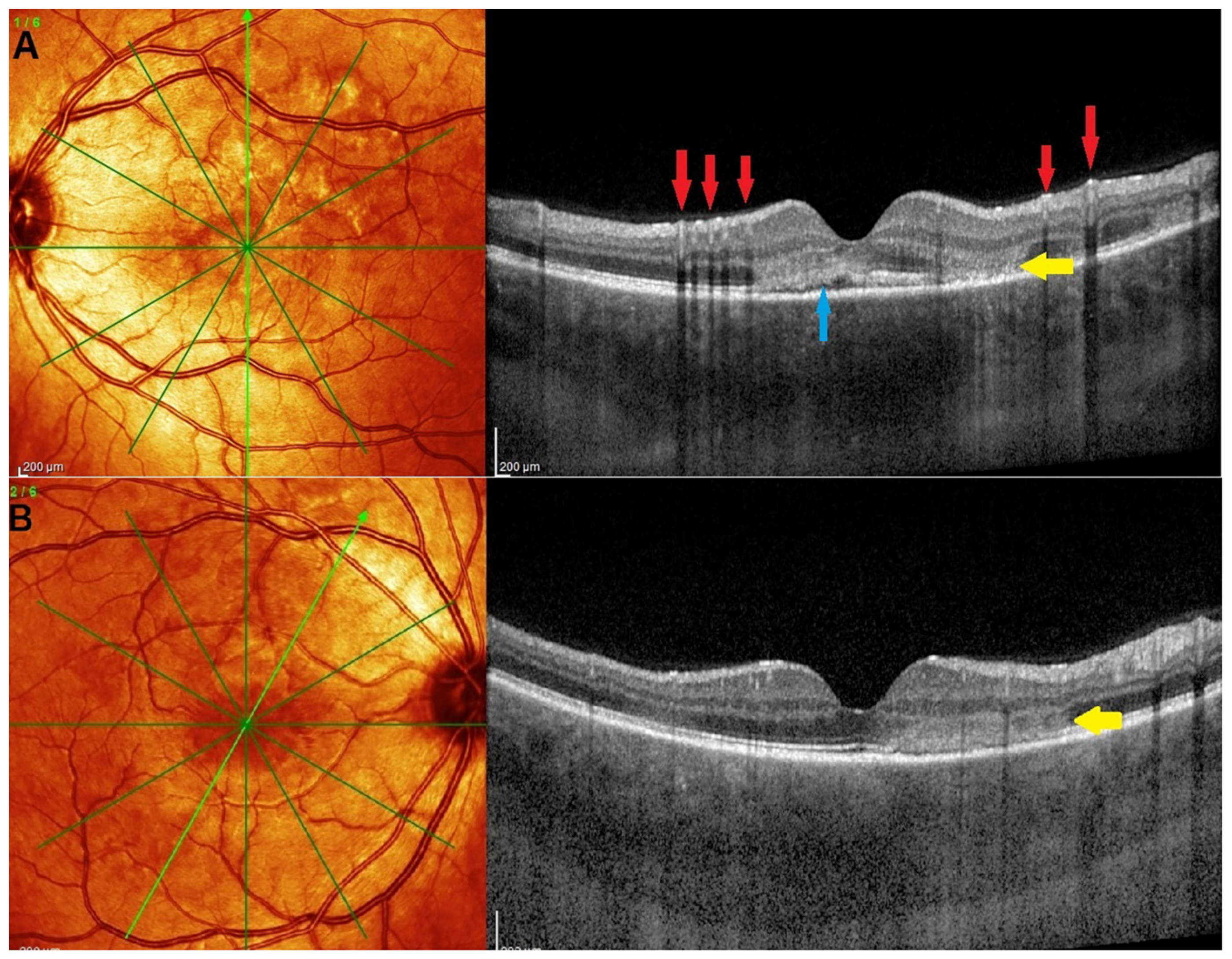 Medicina 58 00165 g010 550