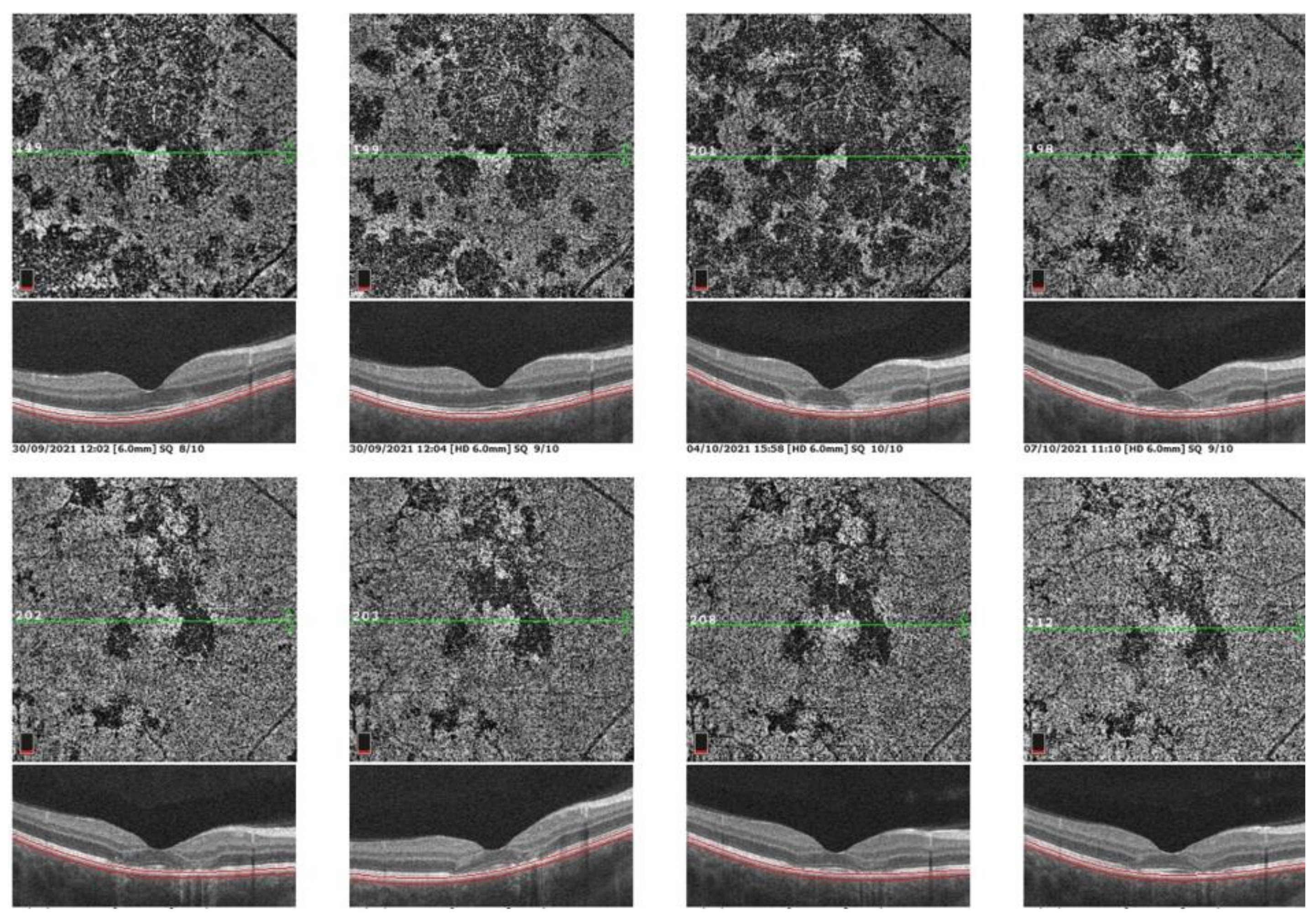 Medicina 58 00165 g012 550