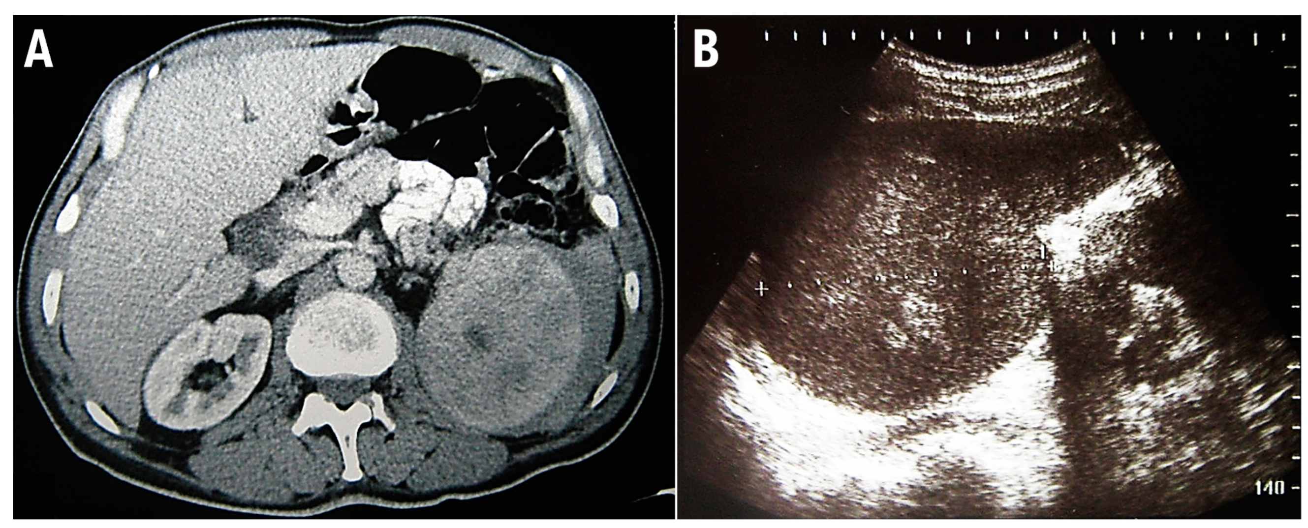 Medicina 58 00184 g002