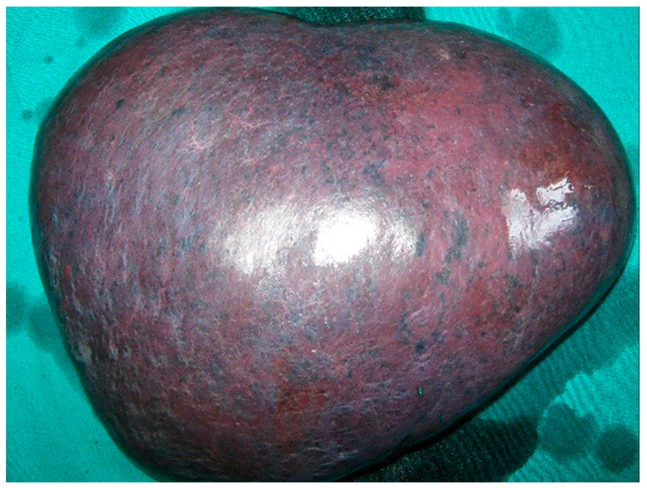 Medicina 58 00184 g003