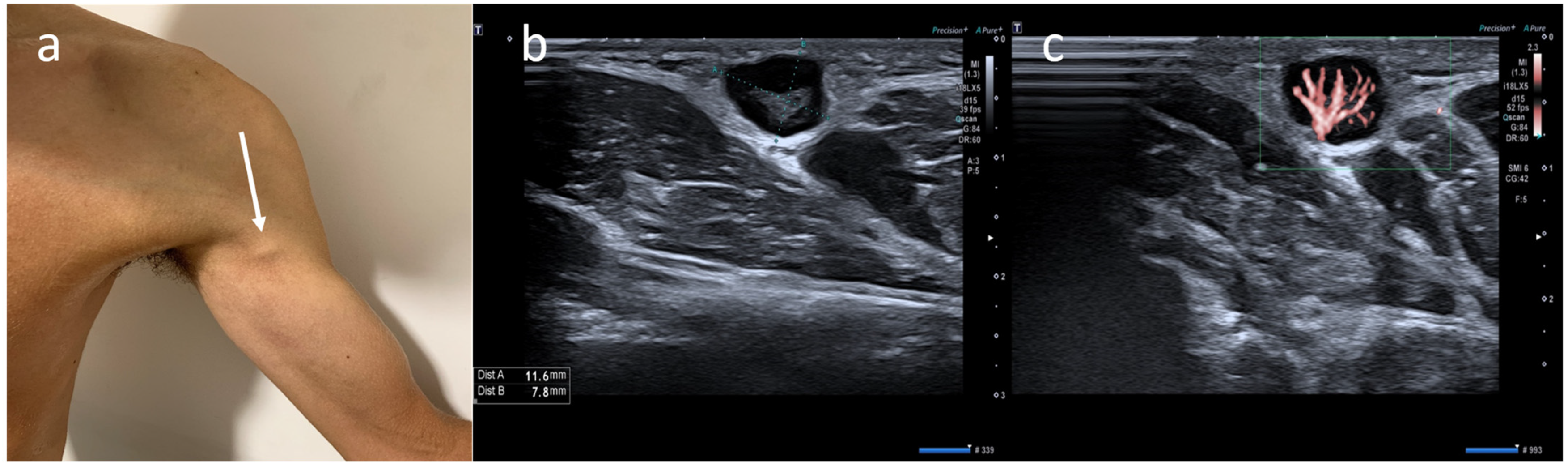 Medicina 58 00197 g002 550