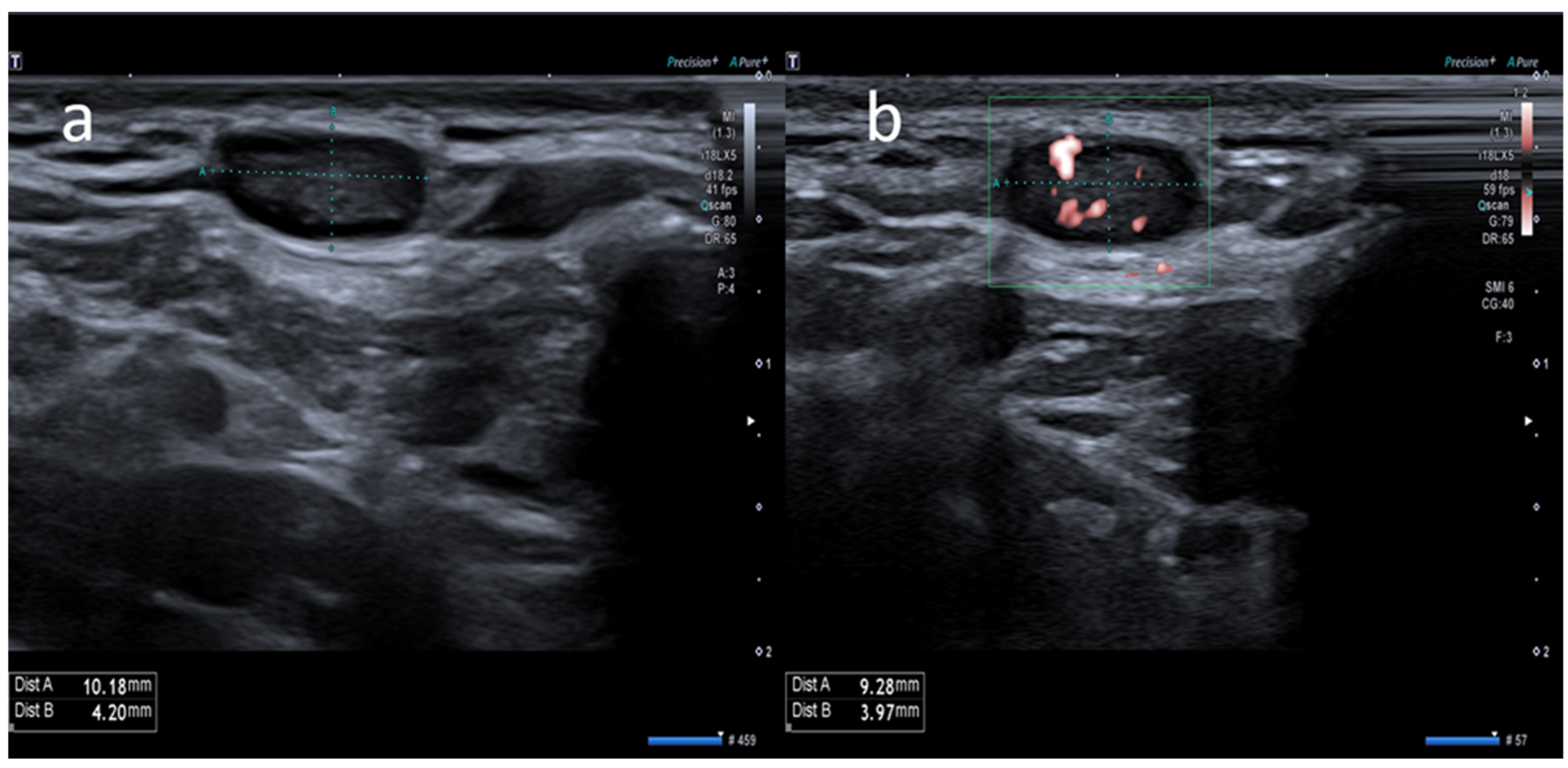 Medicina 58 00197 g005 550